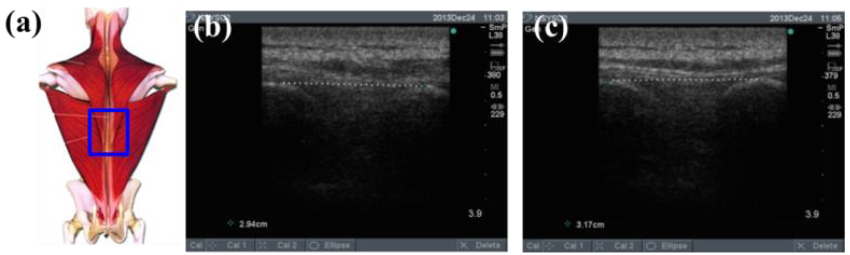 Sensors 15 03975f11 1024