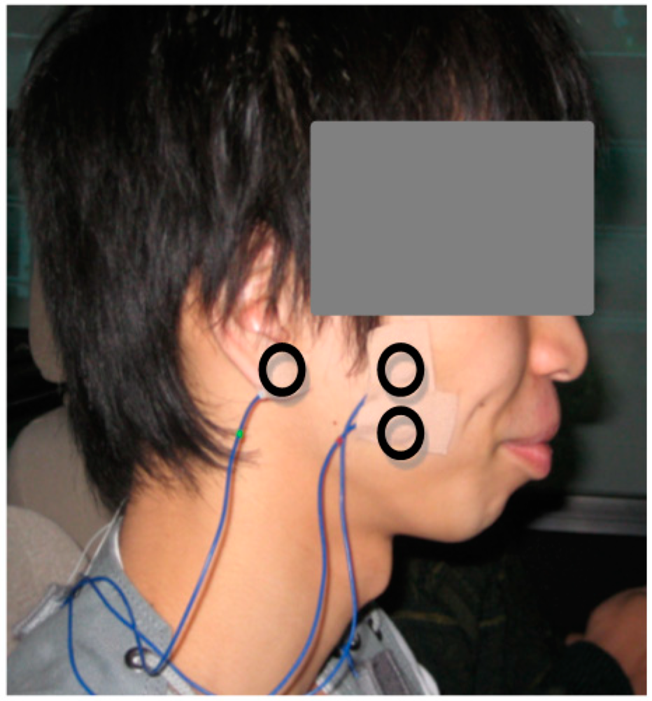 Sensors 15 05136 g004