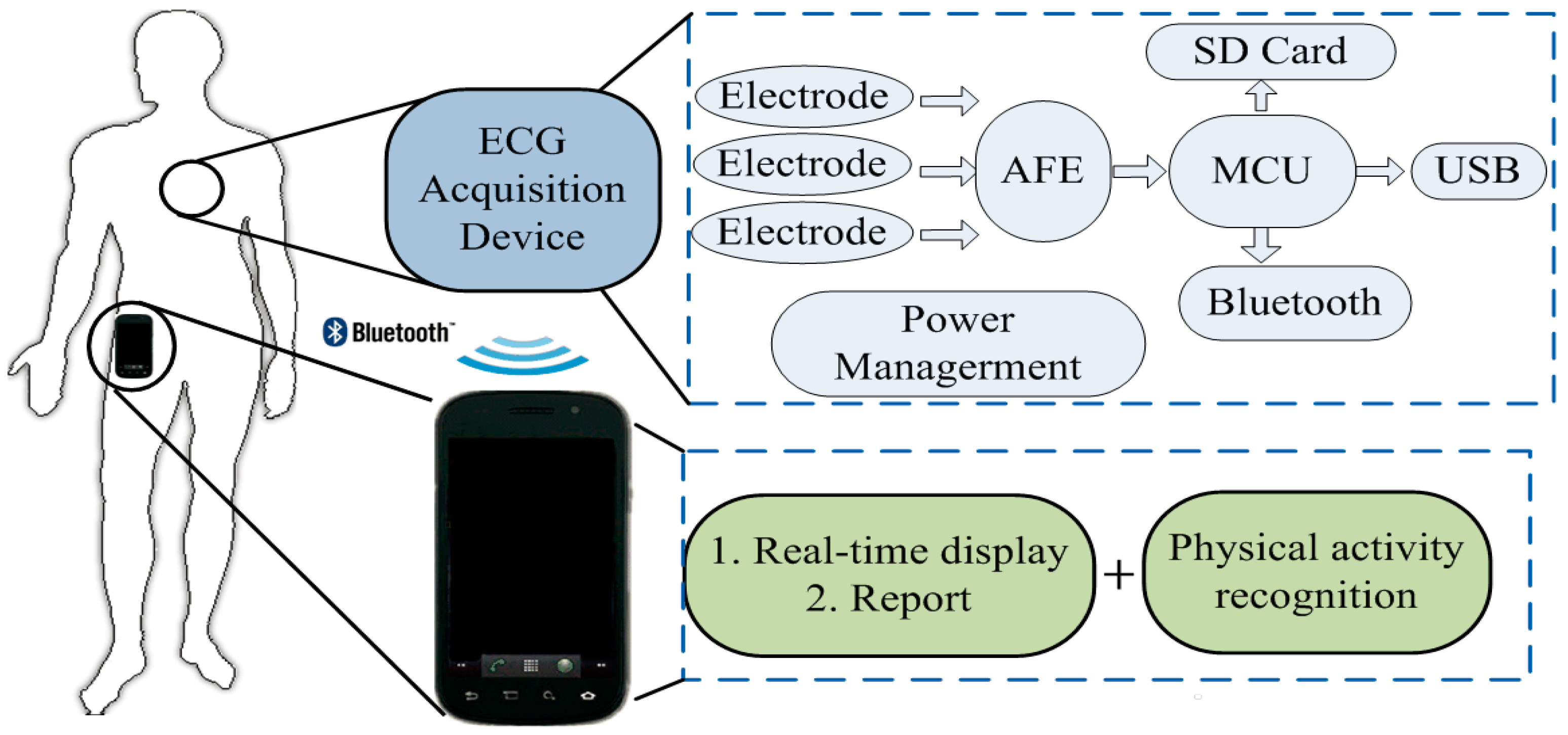 Aware ECG Monitoring System Integrated with Built Circuit Diagram