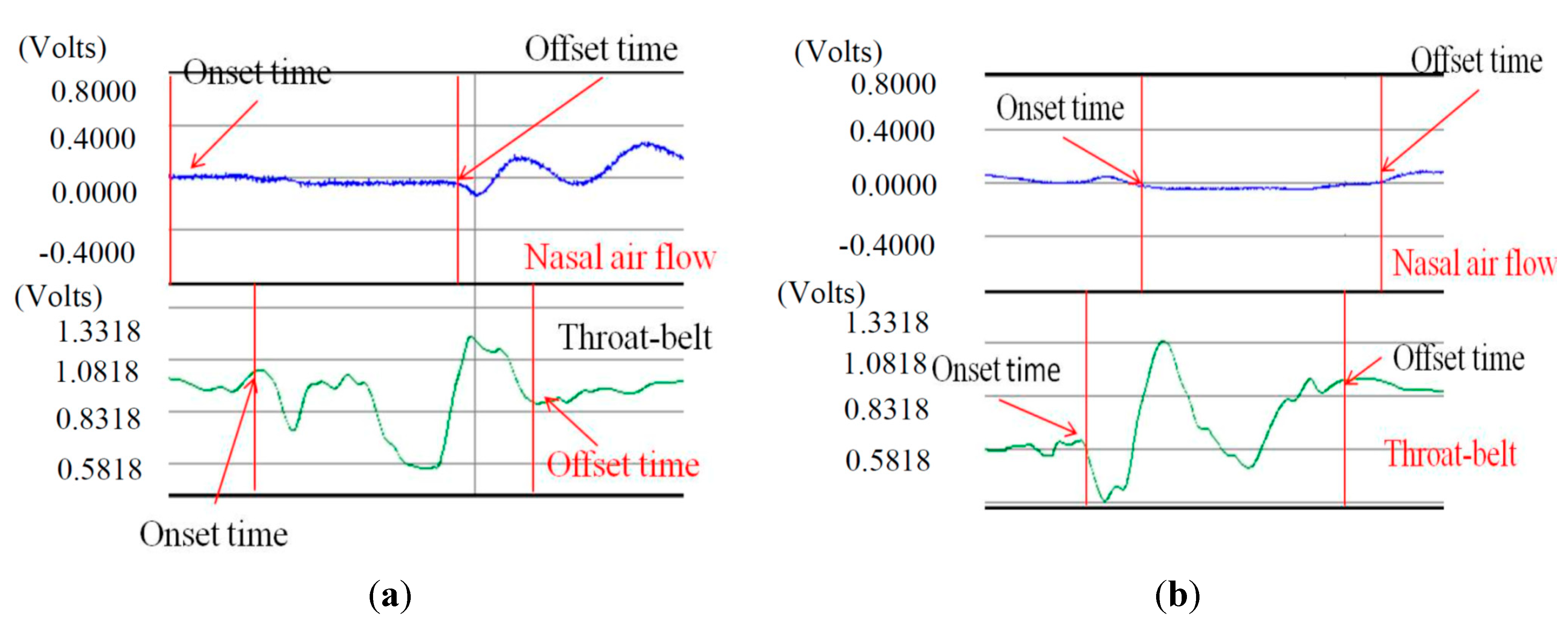 Sensors 15 12428 g012 1024