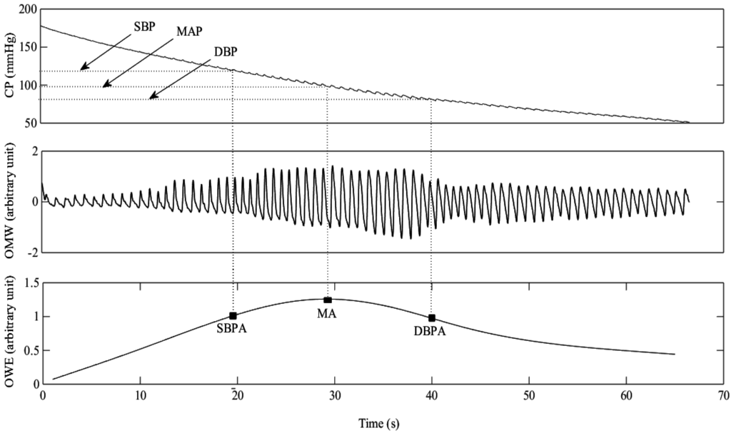 Sensors Free FullText Improved Measurement of Blood Pressure by