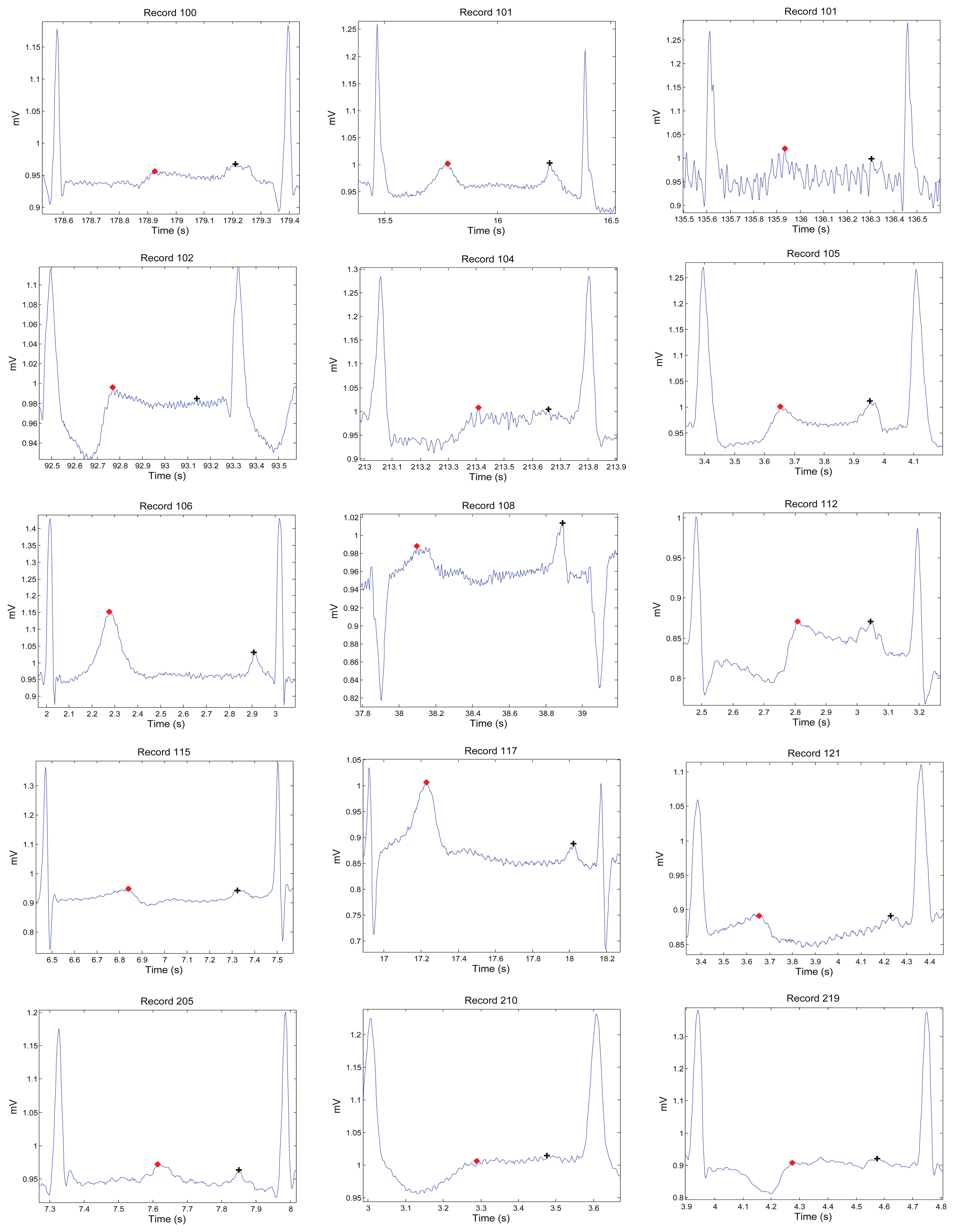 Sensors 15 17693f1 1024