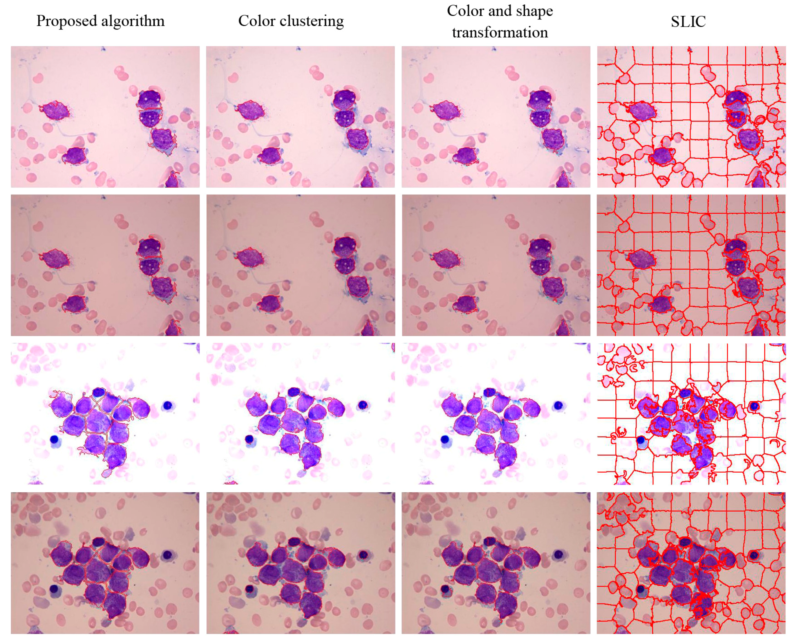 Sensors 15 22561 g017