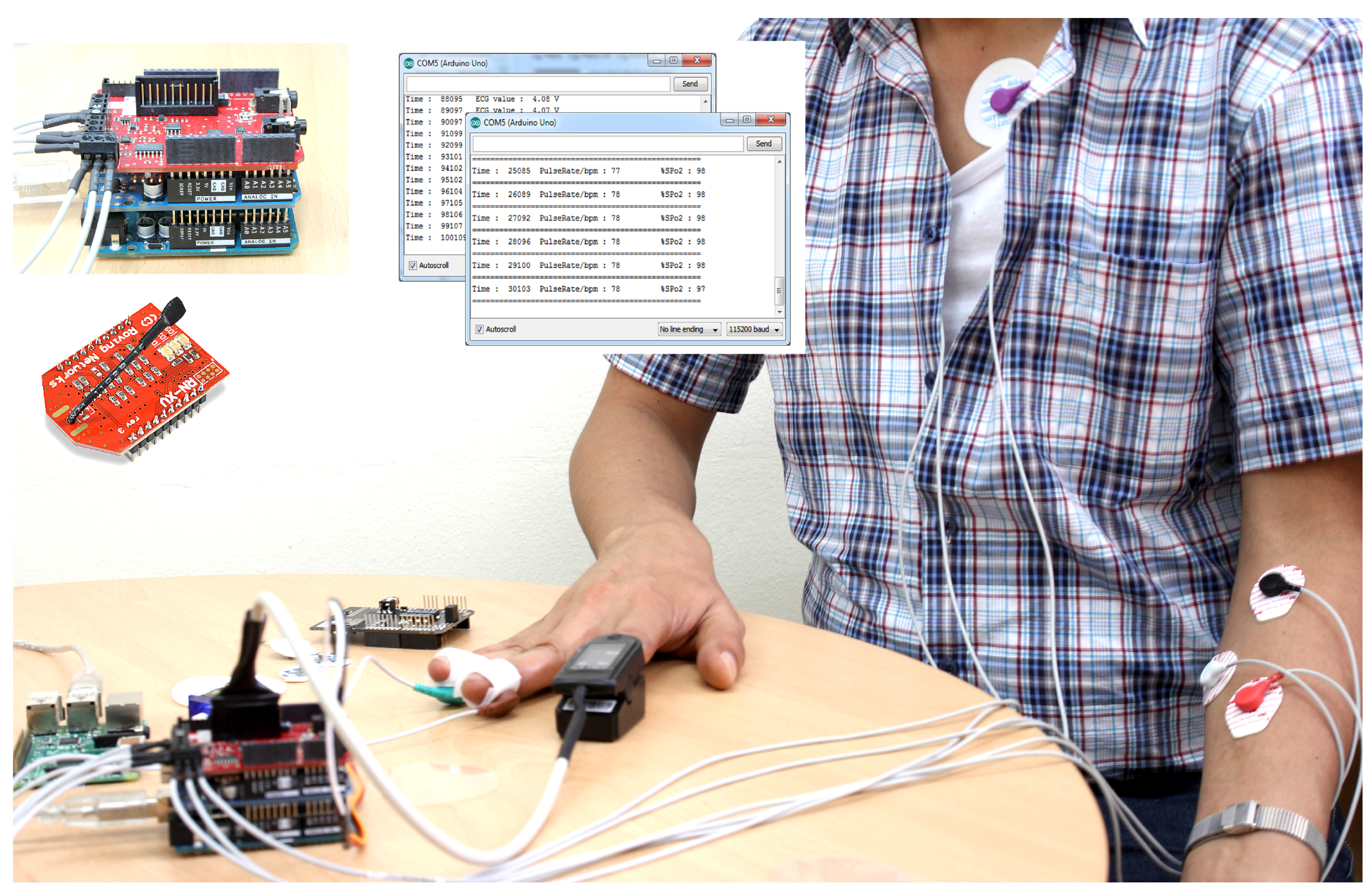 Sensors 15 29819 g015 1024