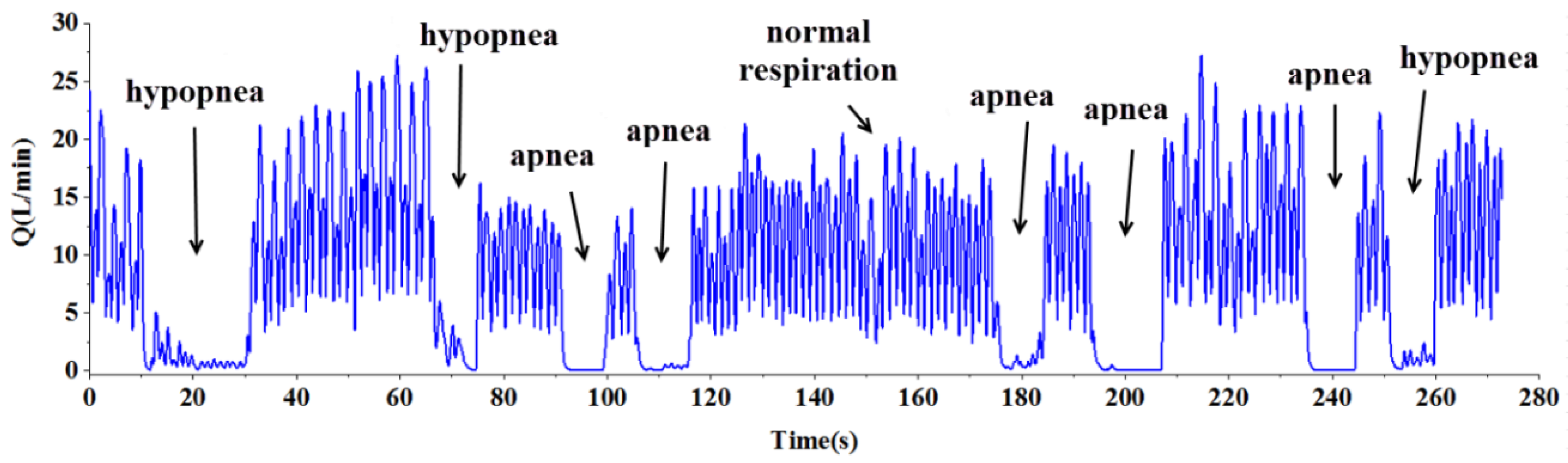 Sensors 15 29881 g013