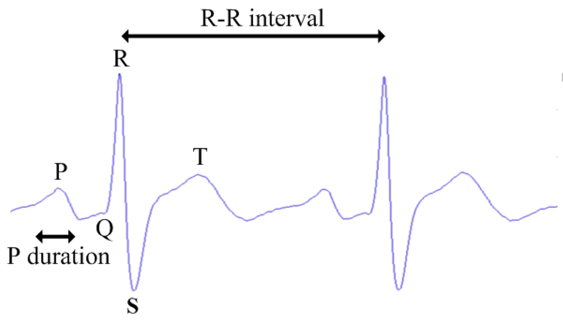 Sensors 16 00659 g003 1024