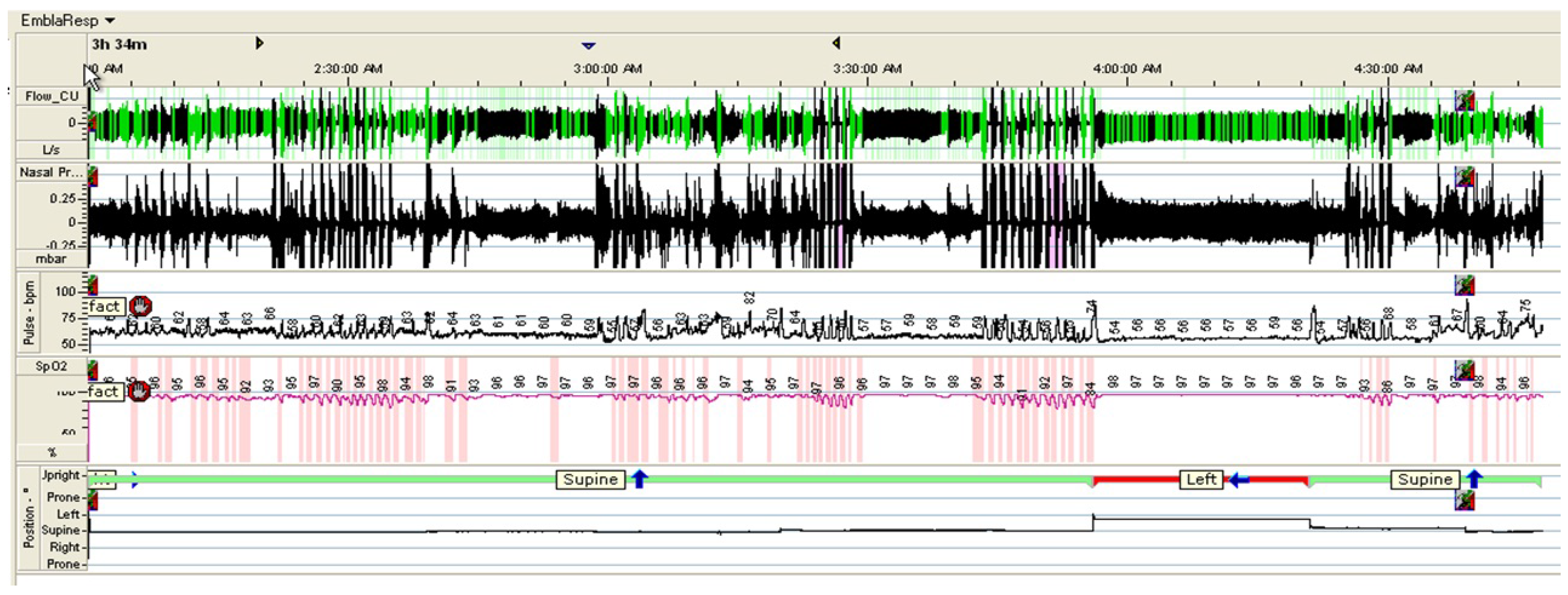 Sensors 16 00750 g005