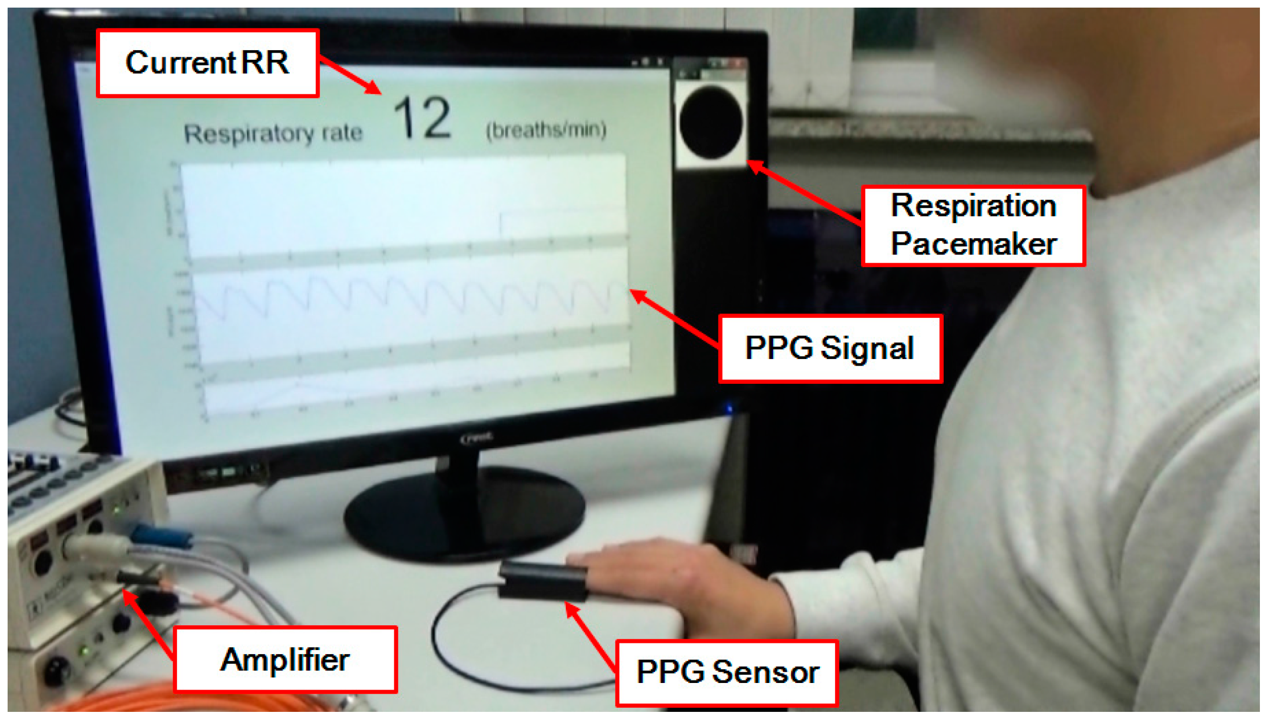 Sensors 16 01494 g006 1024