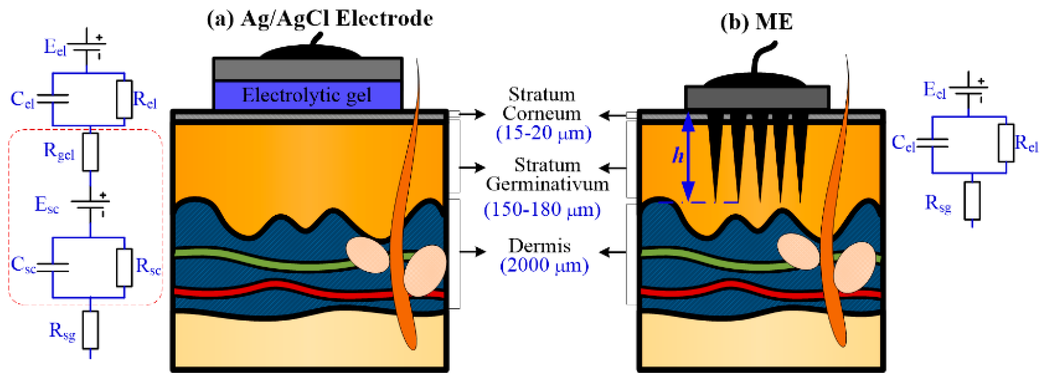 Vitamin D Impacts on Skeletal Muscle Dysfunction in Patients