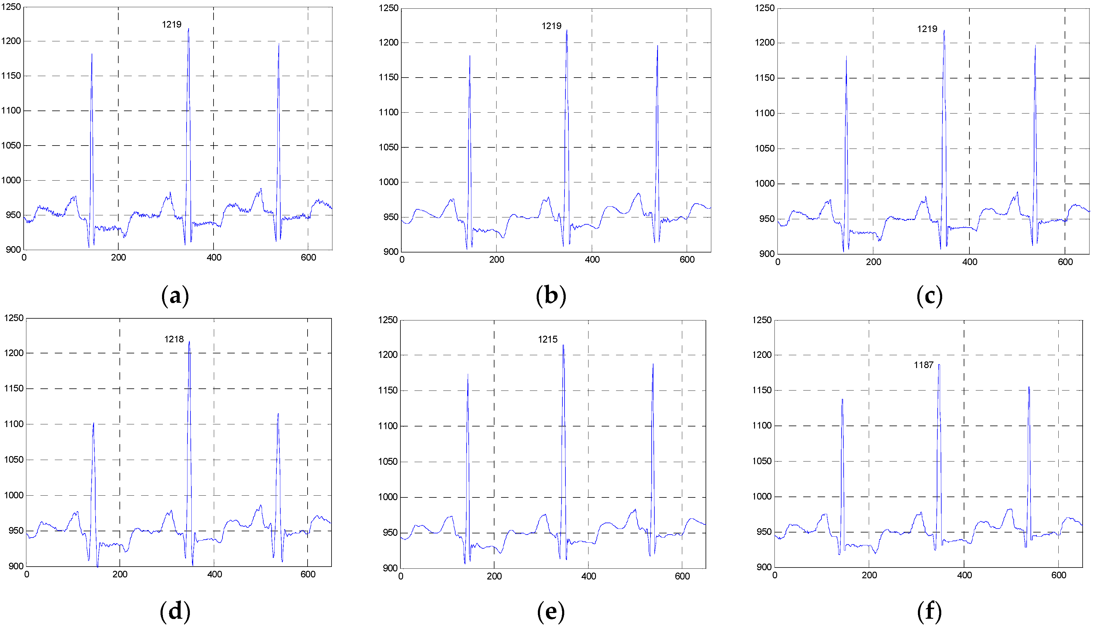 Sensors 16 01584 g011