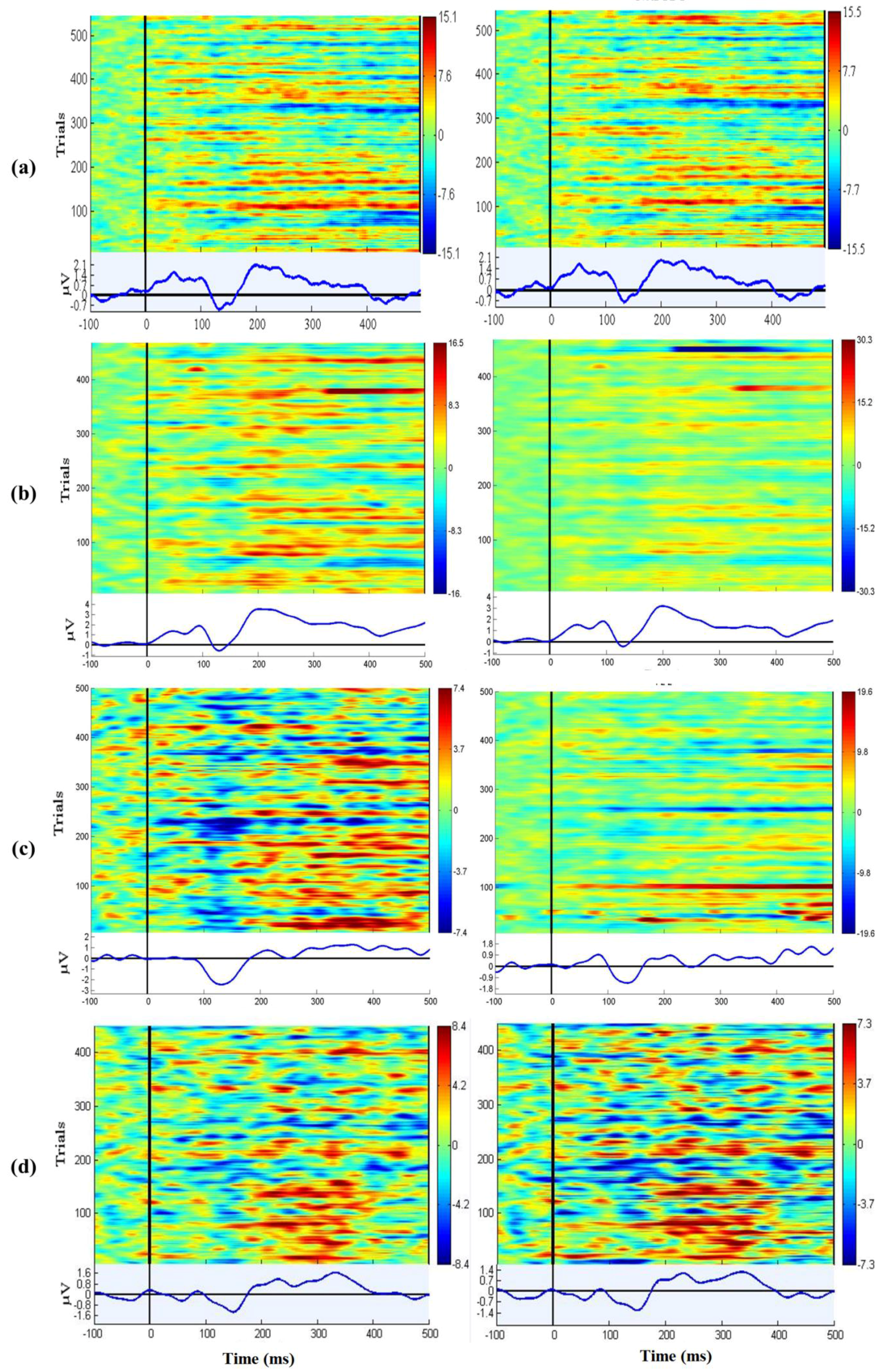 Sensors 16 01826 g011a