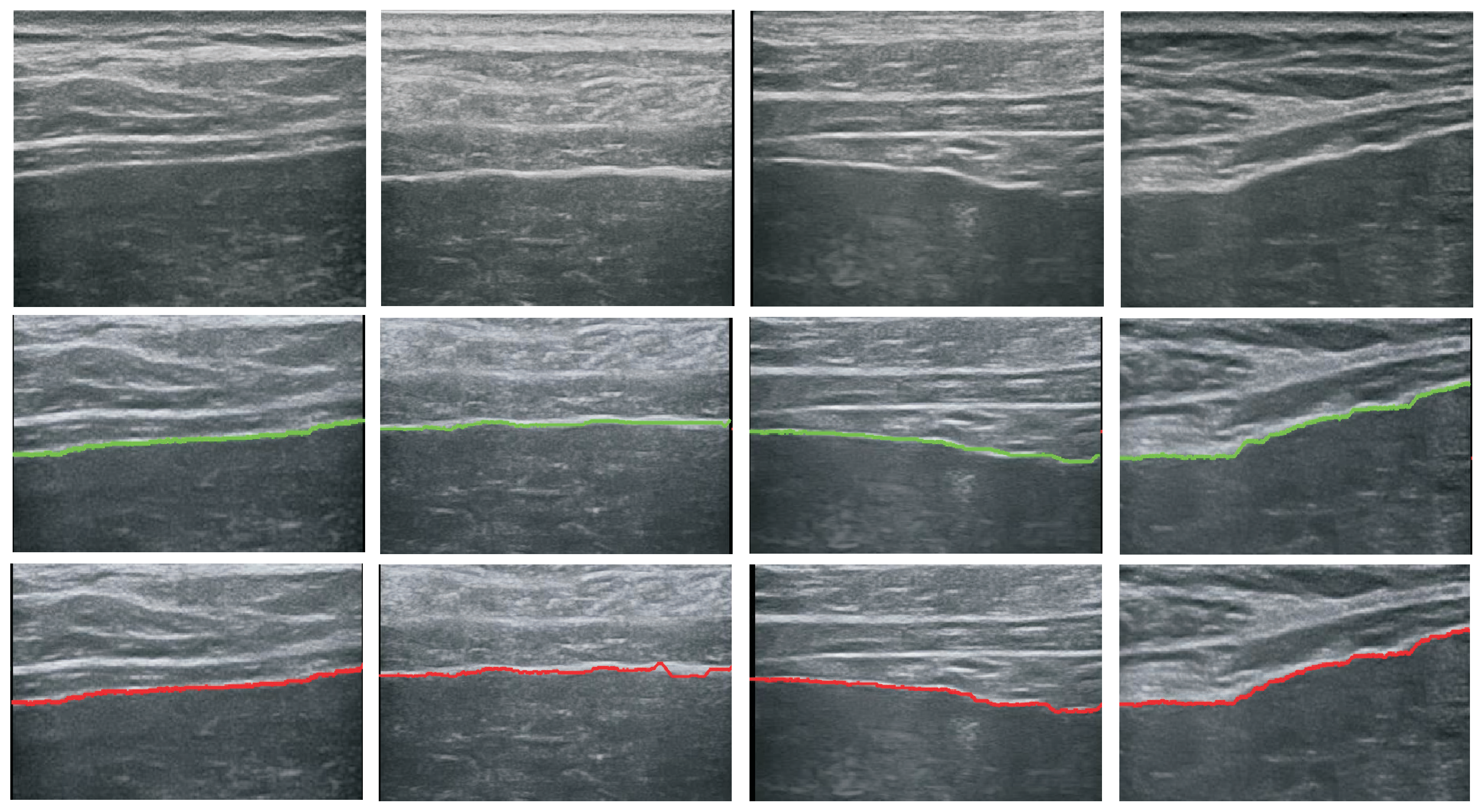 Sensors 17 00149 g008 550