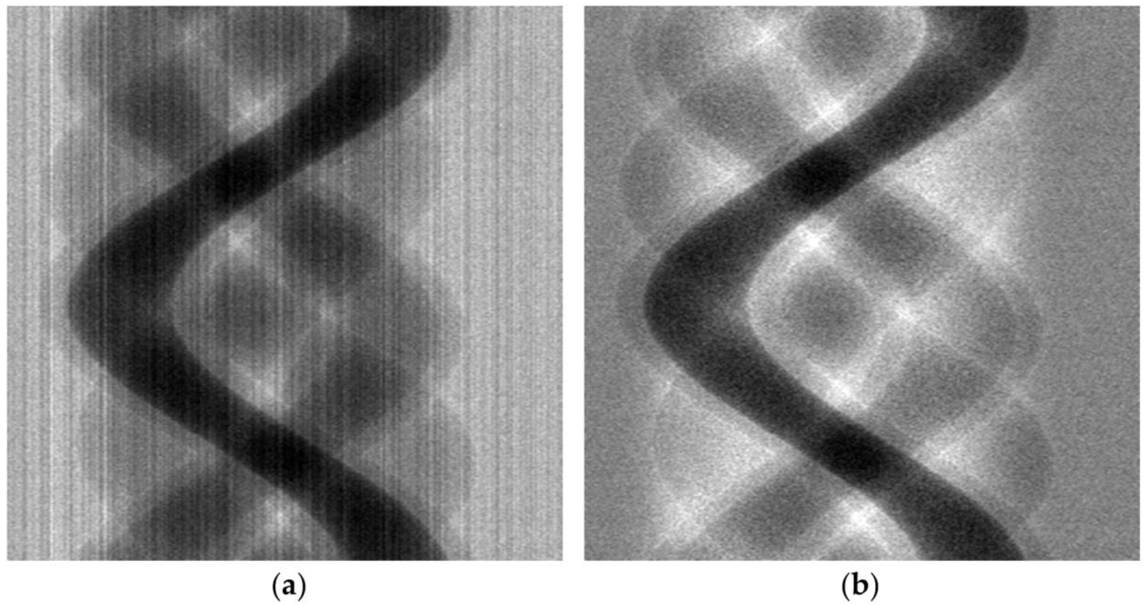 CT image restoration method via total variation and L 0 smoothing filter