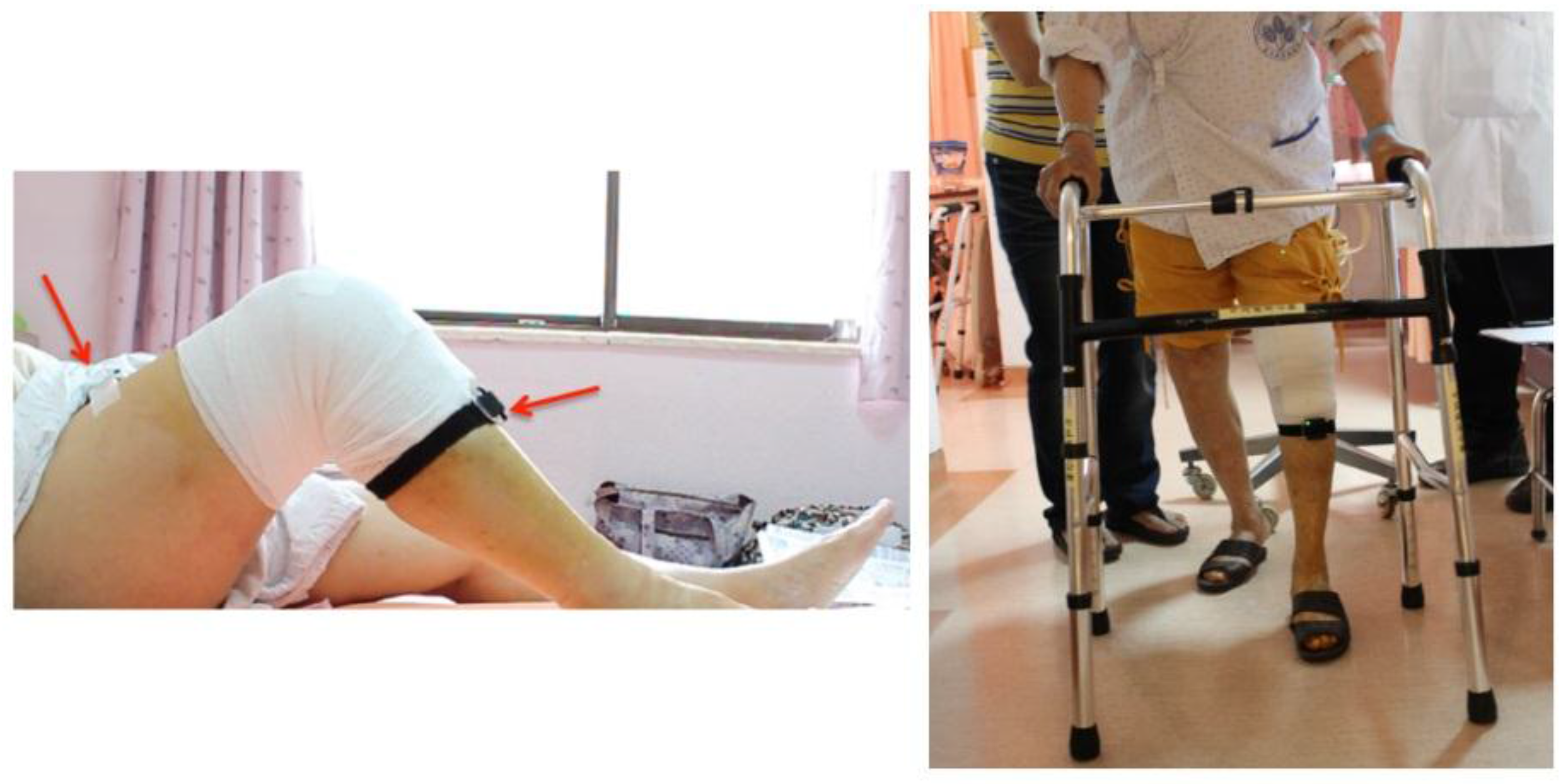 Sensors 17 00418 g005 550