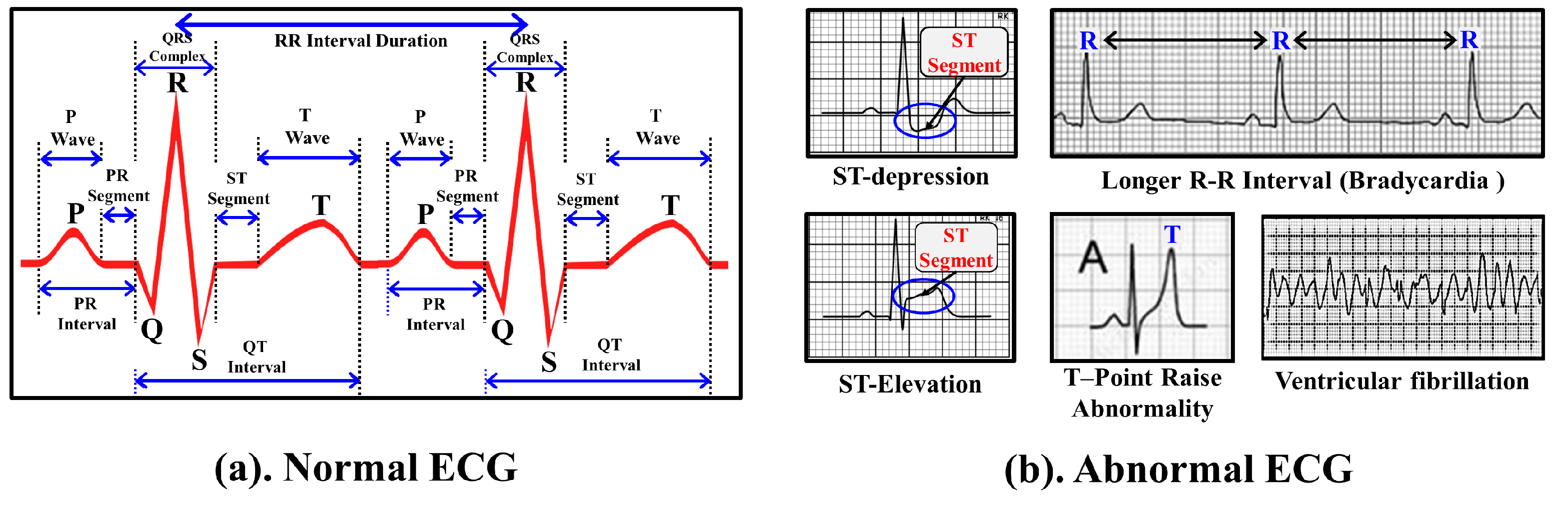 Sensors 17 00711 g005