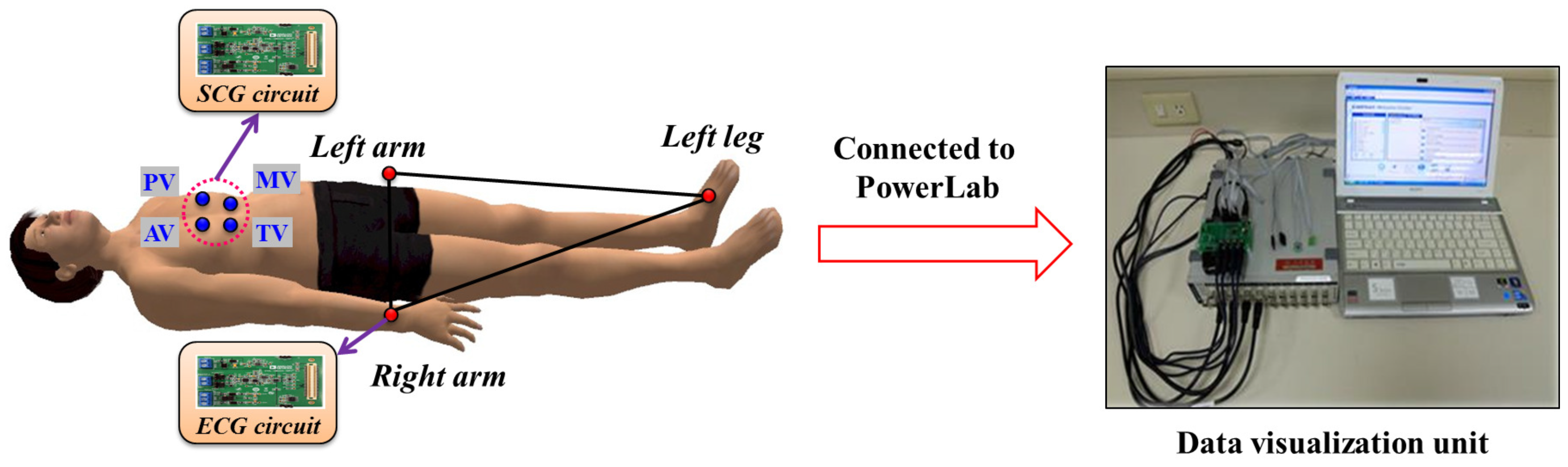 Sensors Free FullText A Cardiac Early Warning System with Multi