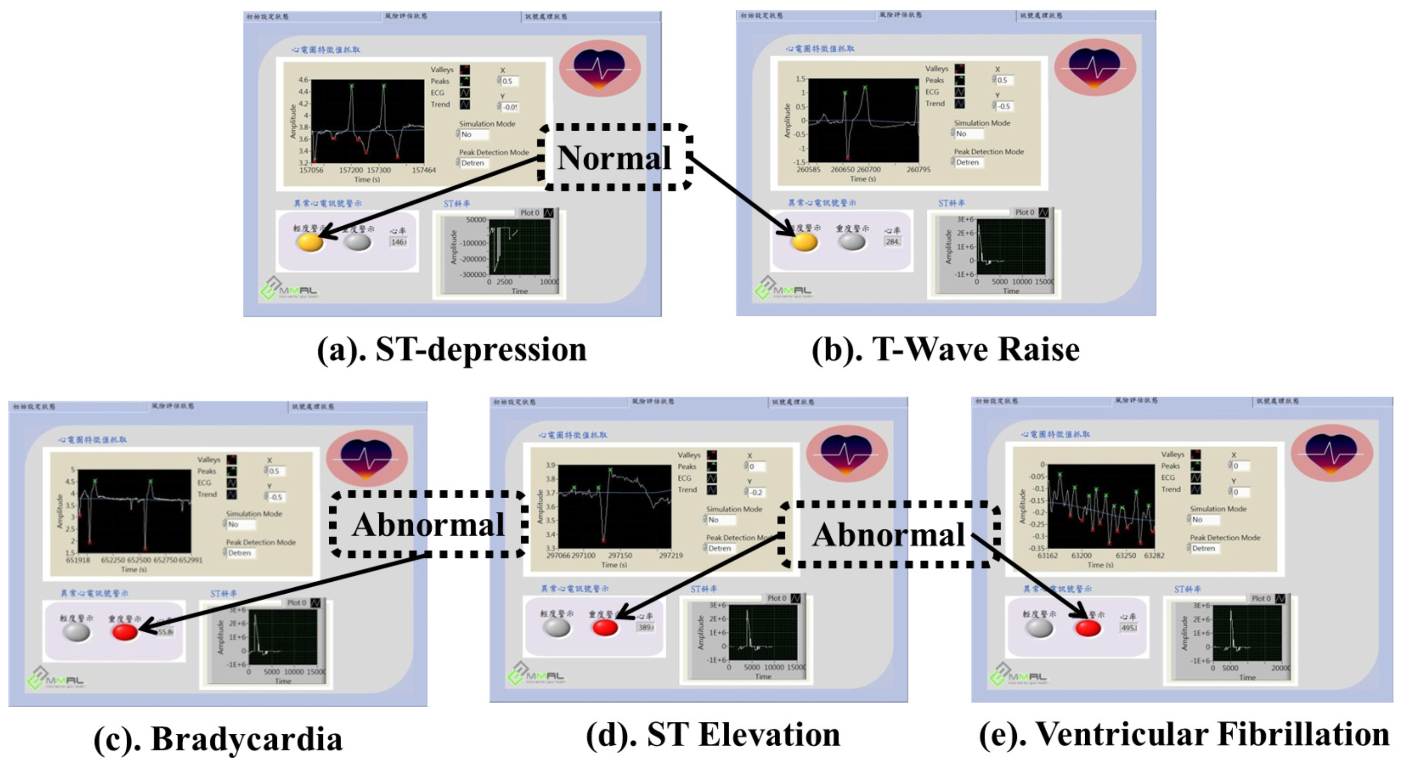 Sensors 17 00711 g016