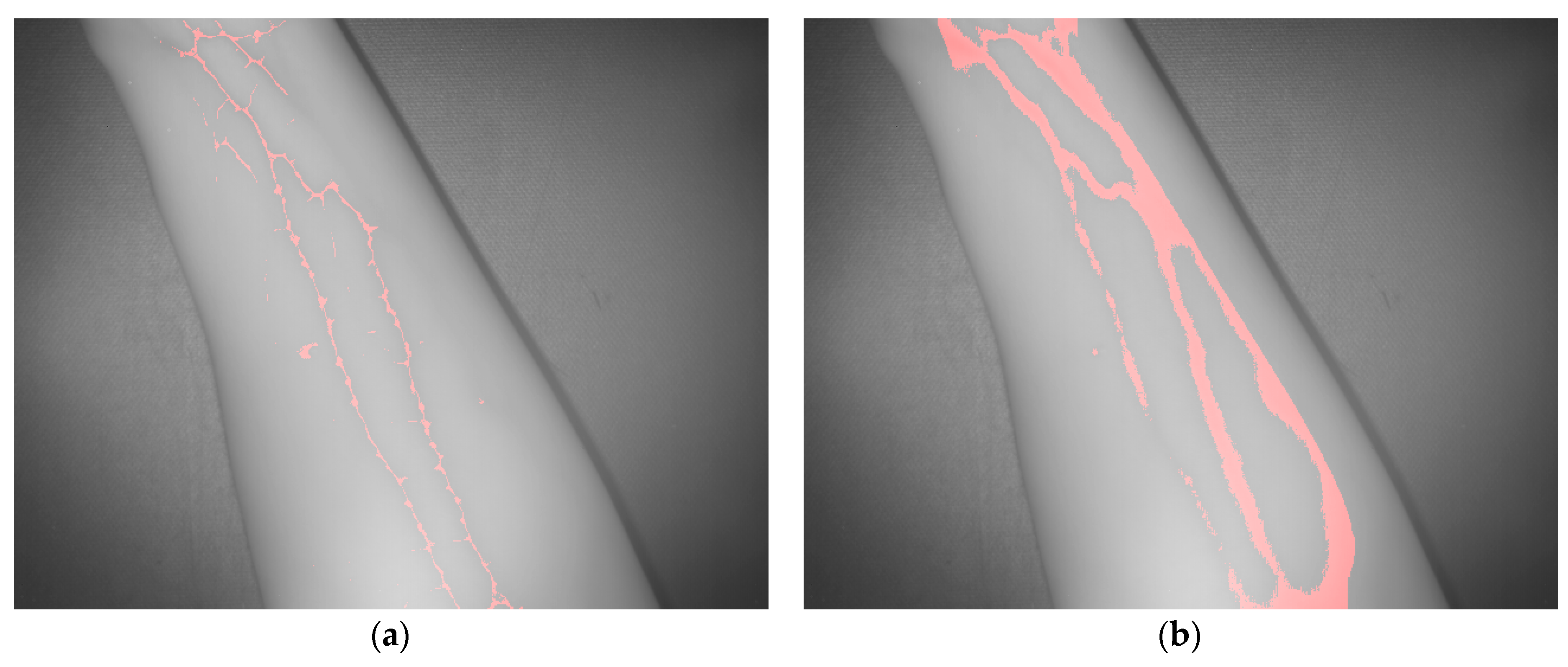 Sensors 17 00897 g013