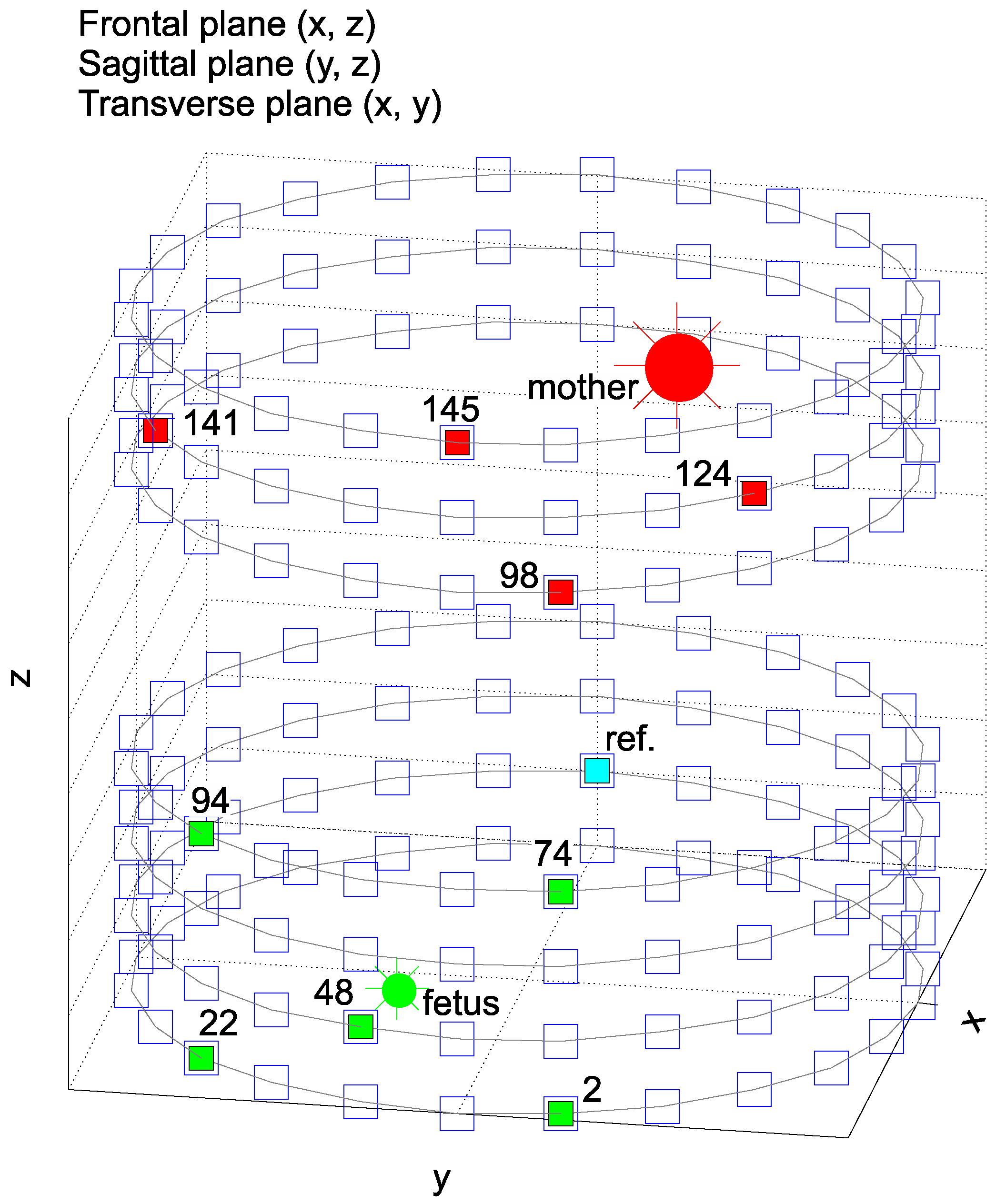 Sensors 17 01154 g006 550