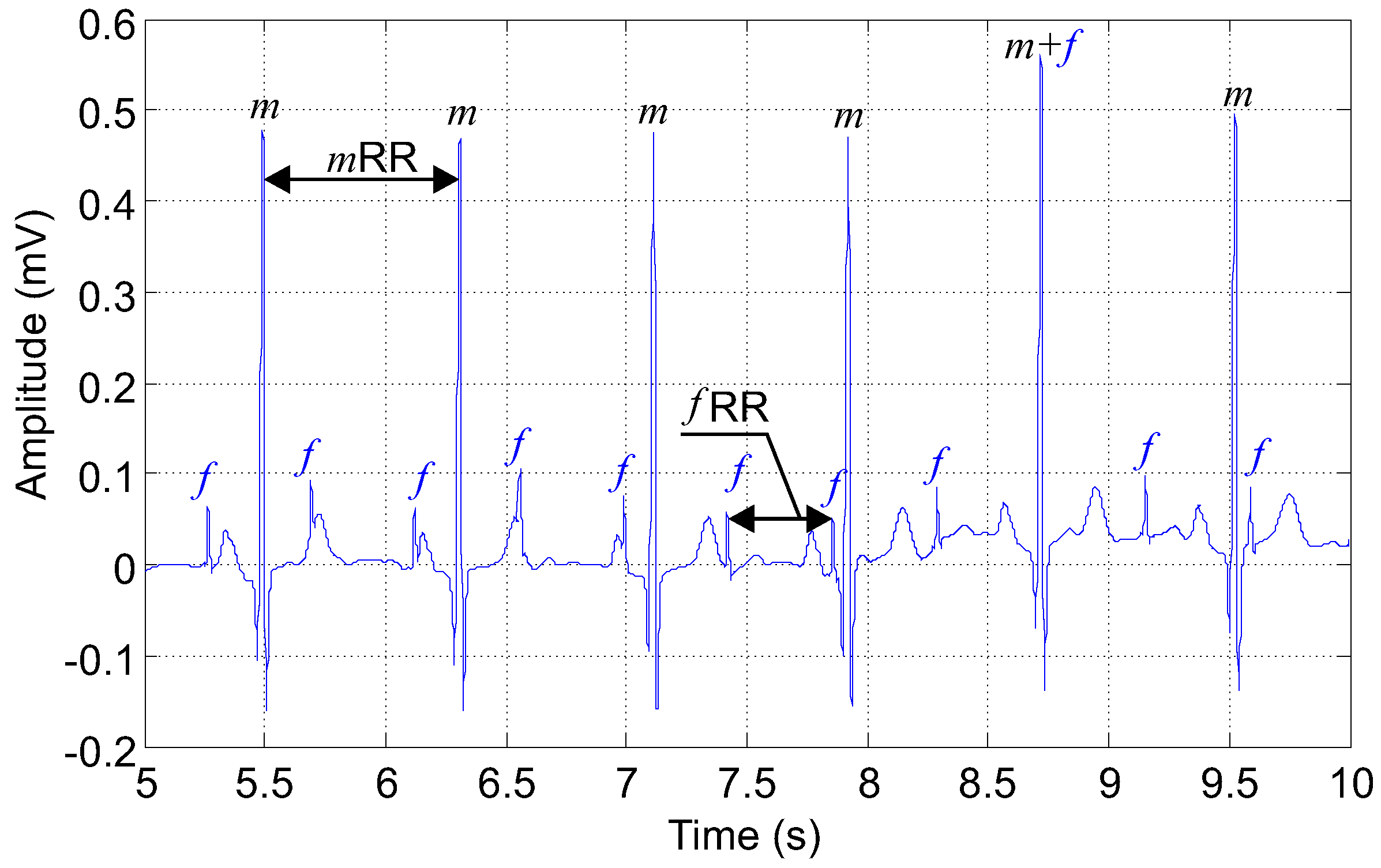 Sensors 17 01154 g007 550