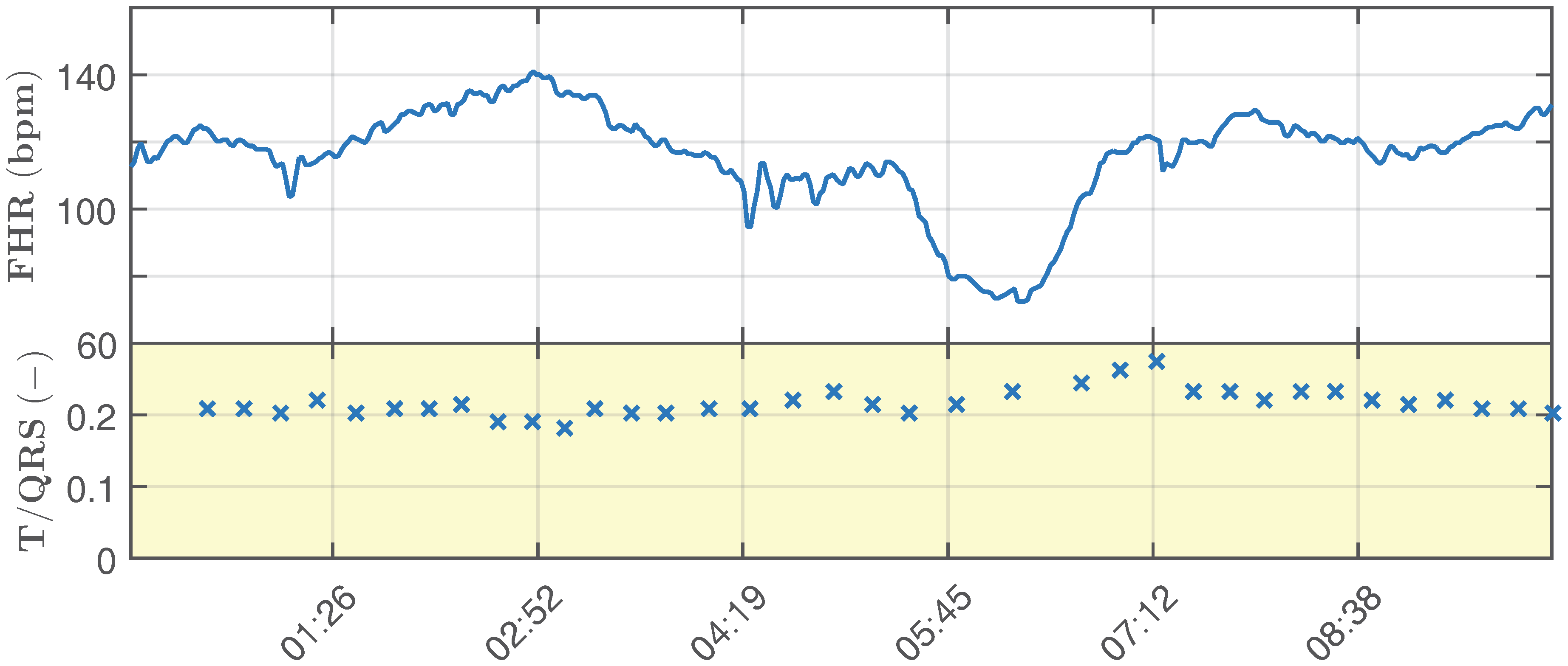 Sensors 17 01154 g009 550