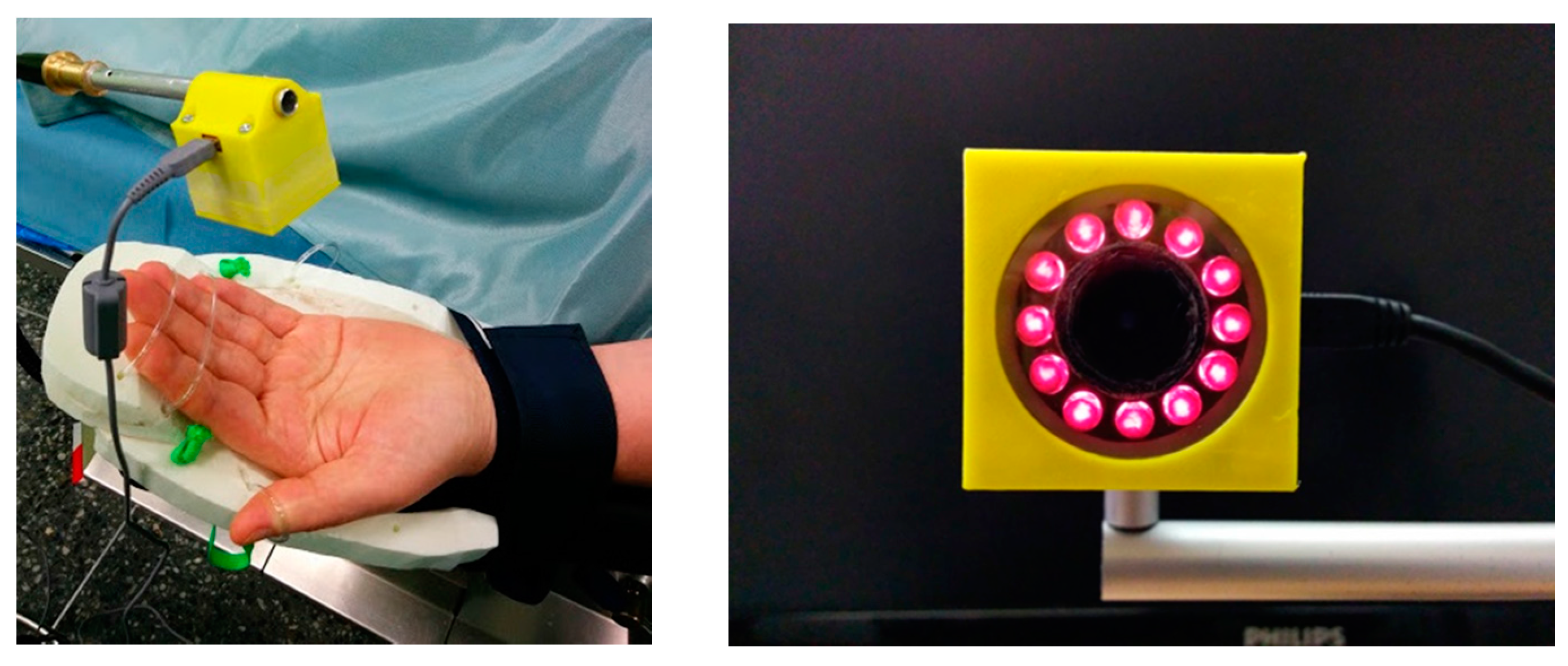 Sensors 17 01165 g011 550