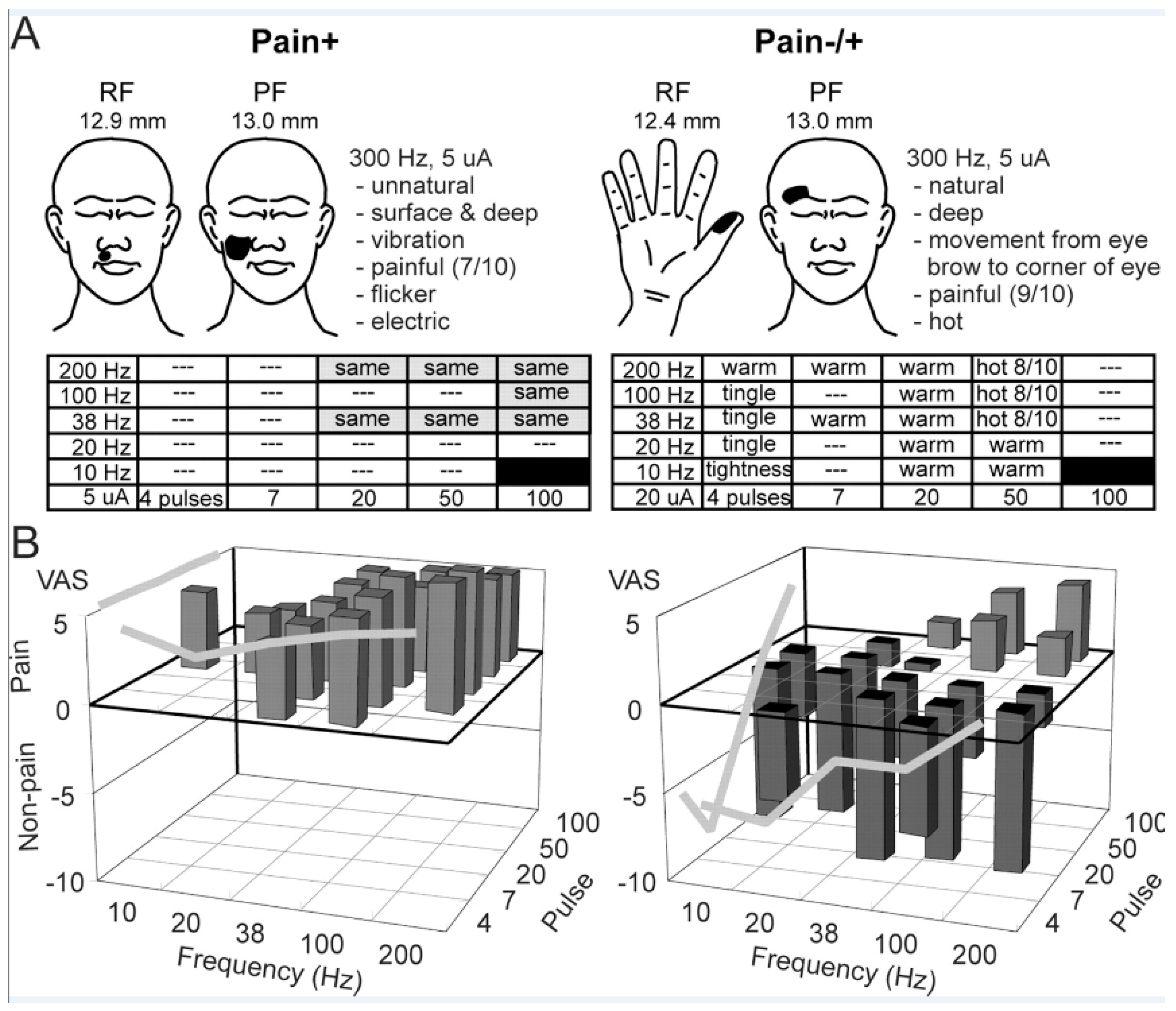 Sensors 17 01197 g003 550