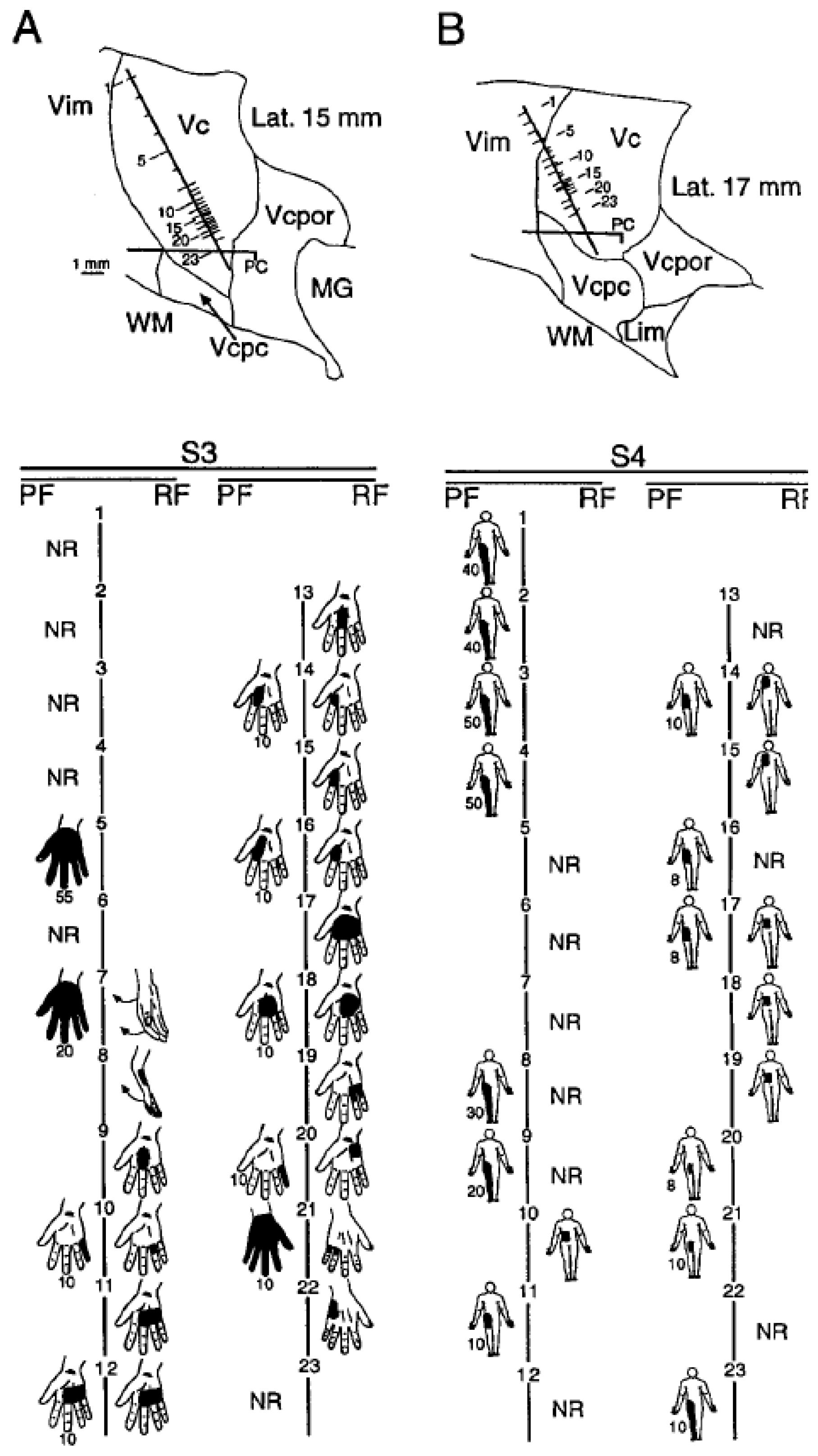 Sensors 17 01197 g004 550