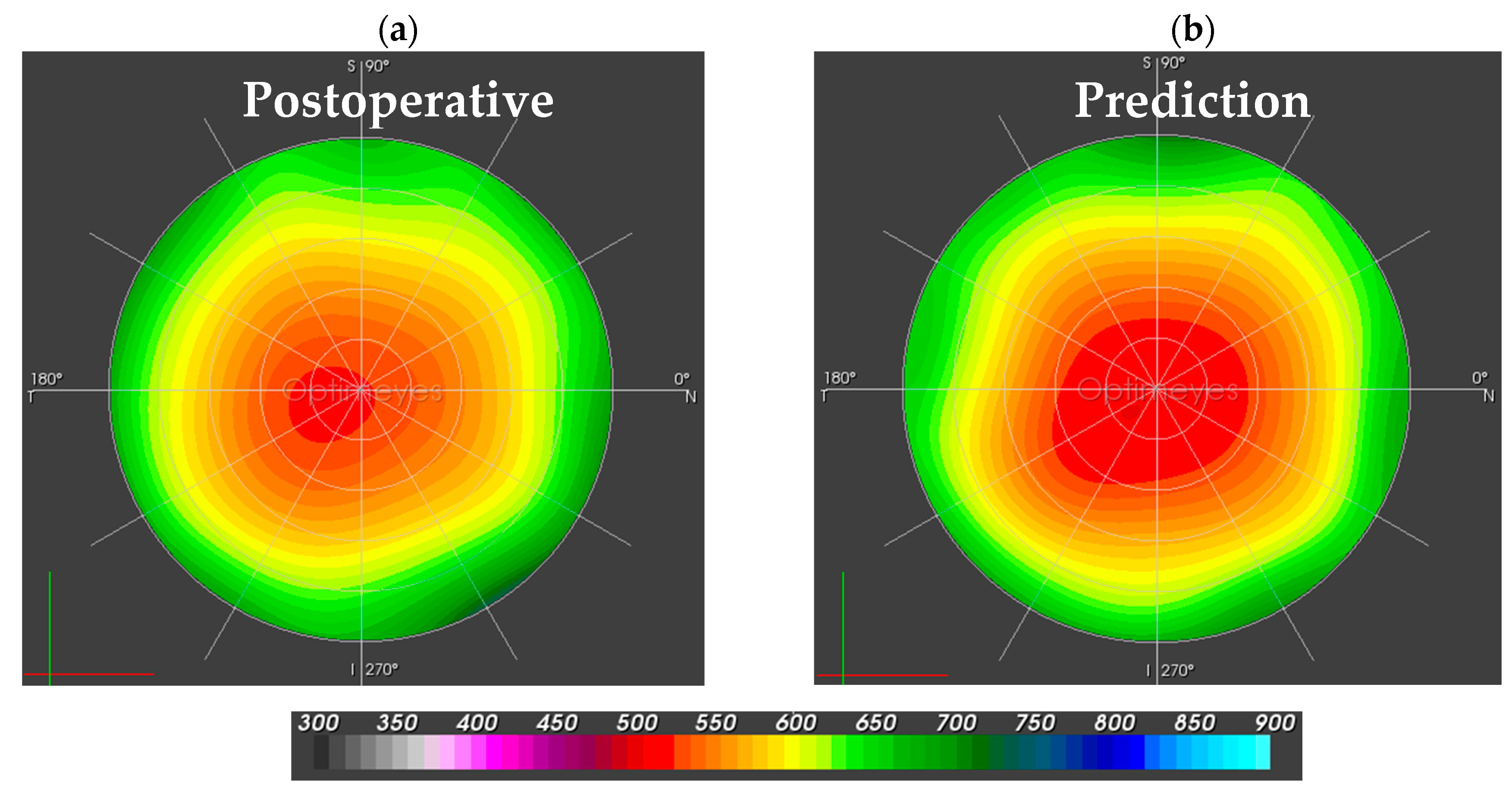 Sensors 17 01200 g005 550
