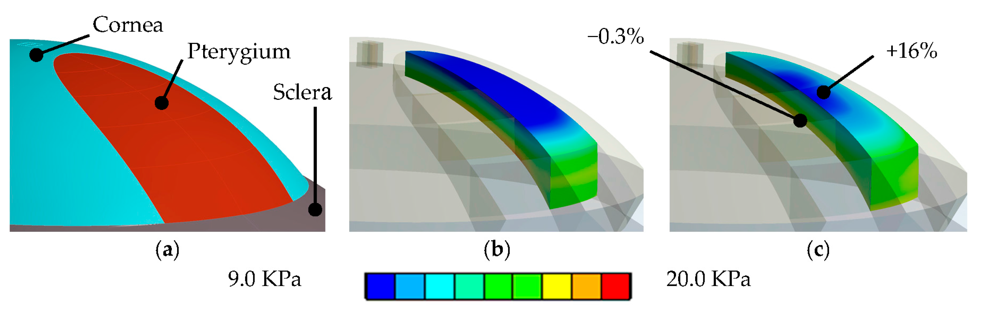 Sensors 17 01200 g007 550