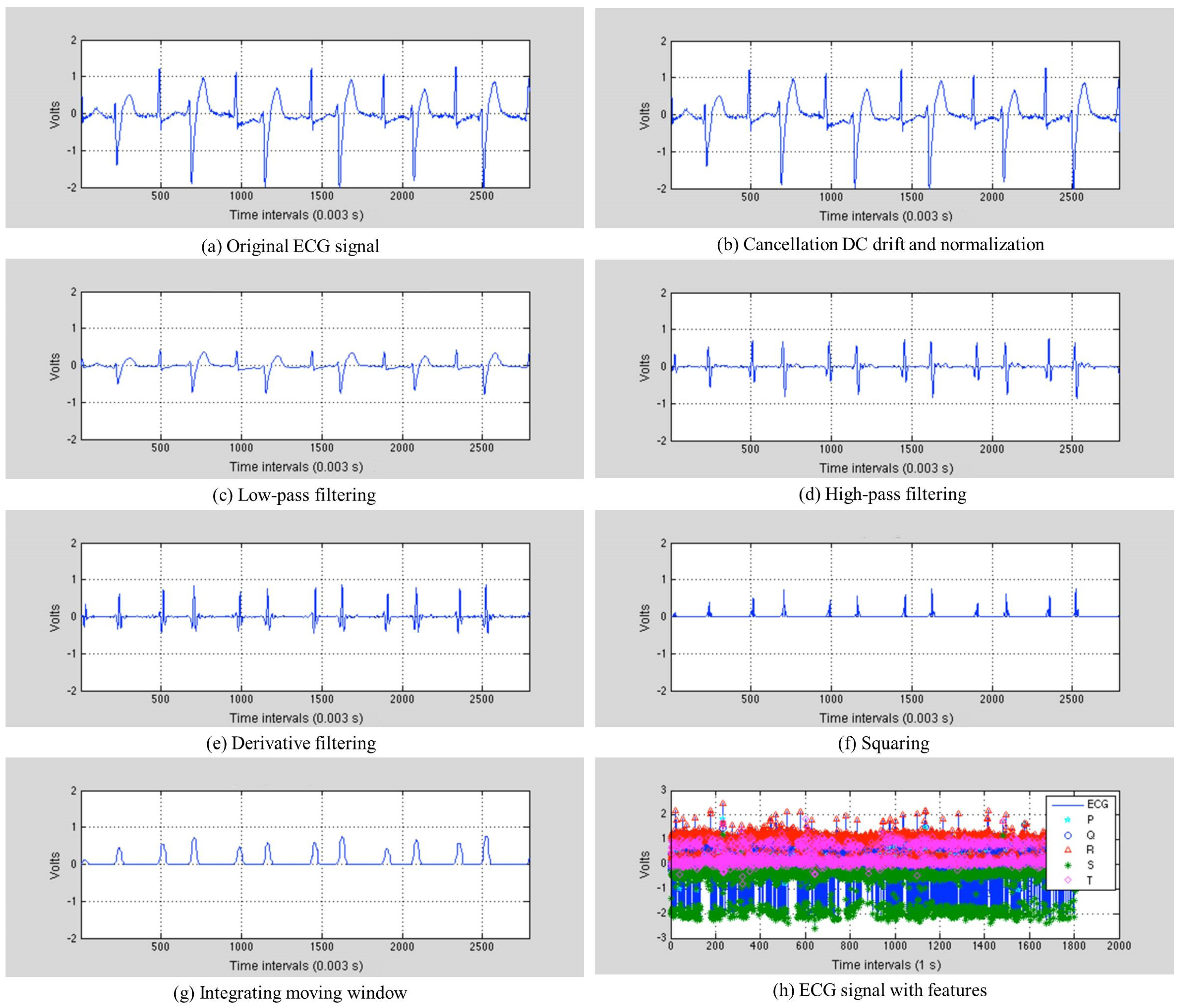 Sensors 17 01360 g005 550