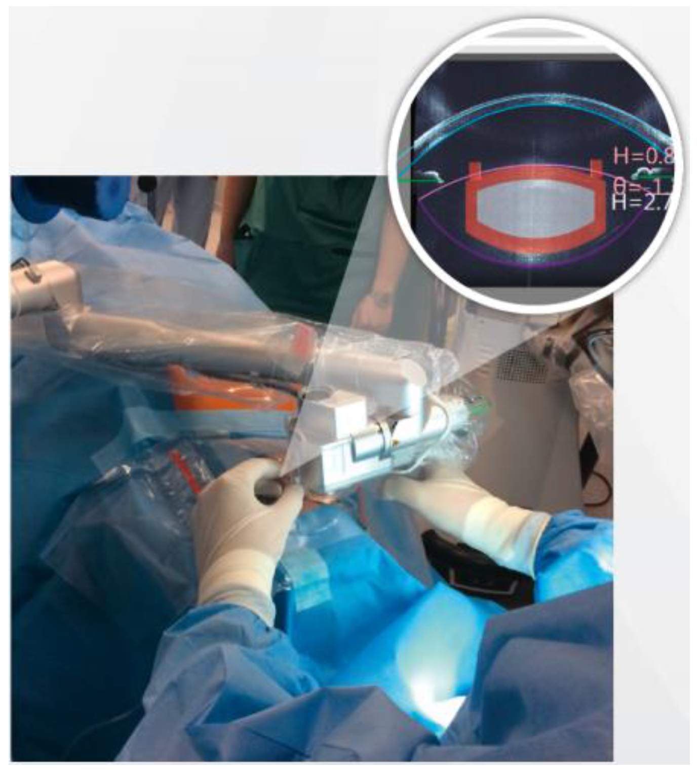 Sensors 17 01429 g002 550