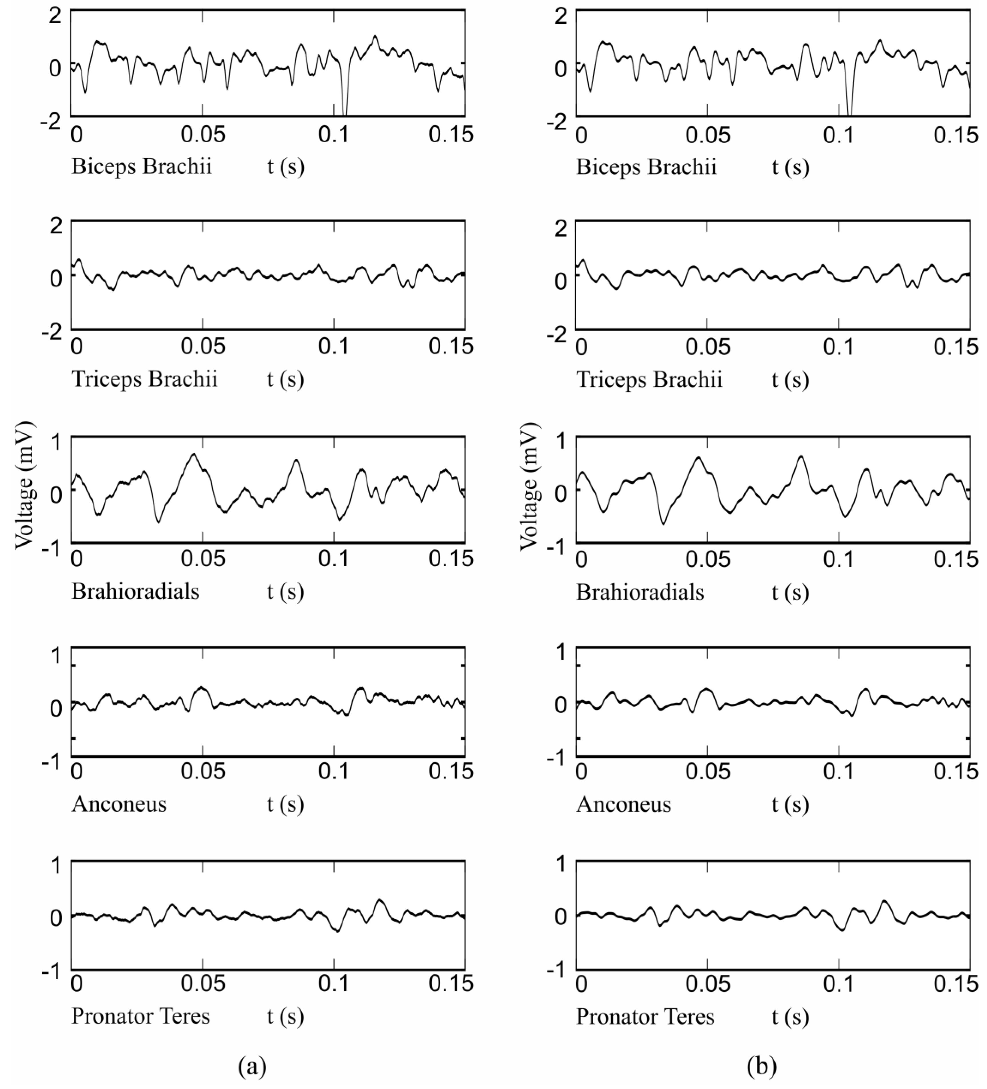 Sensors 17 01597 g013
