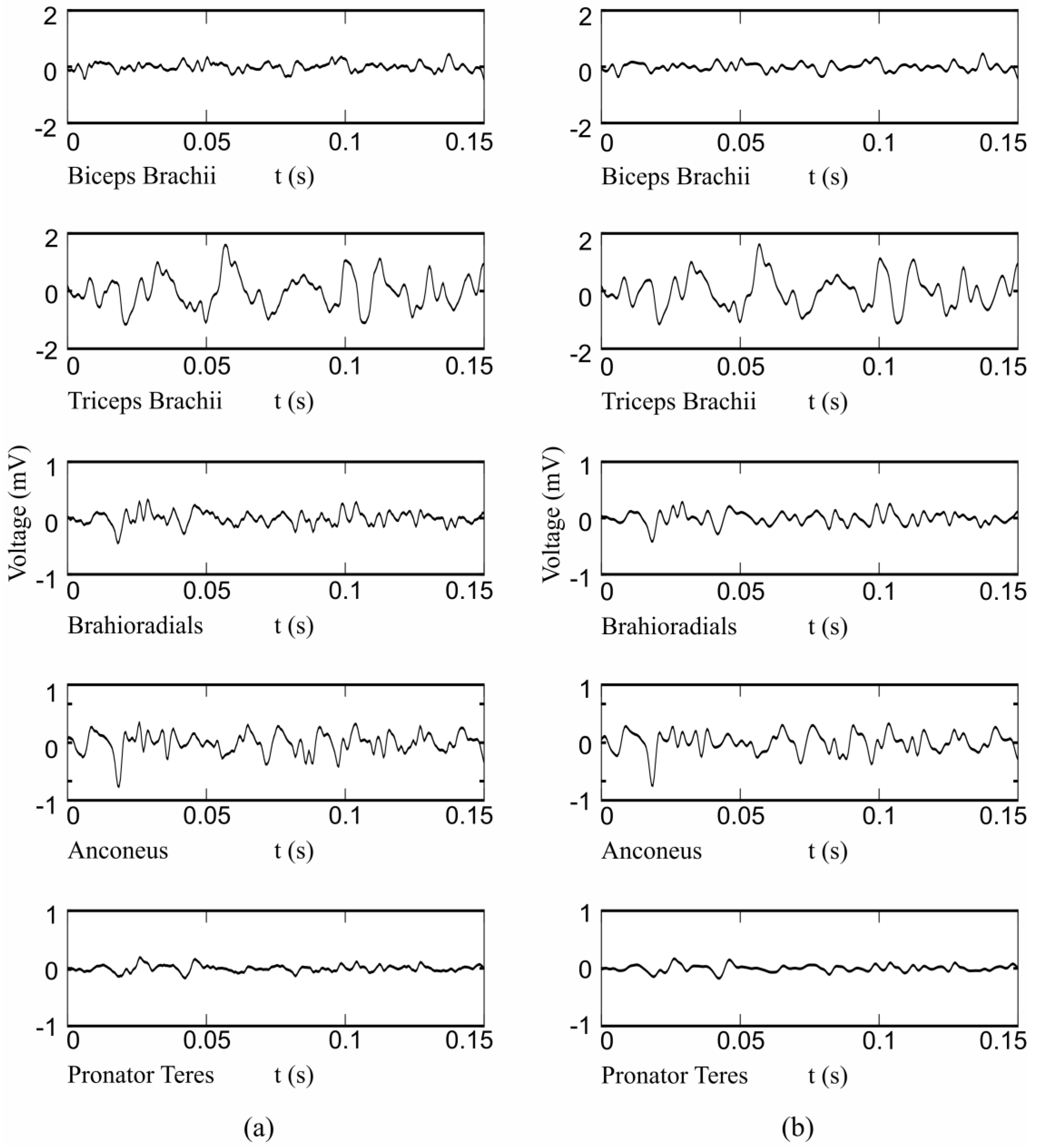 Sensors 17 01597 g014