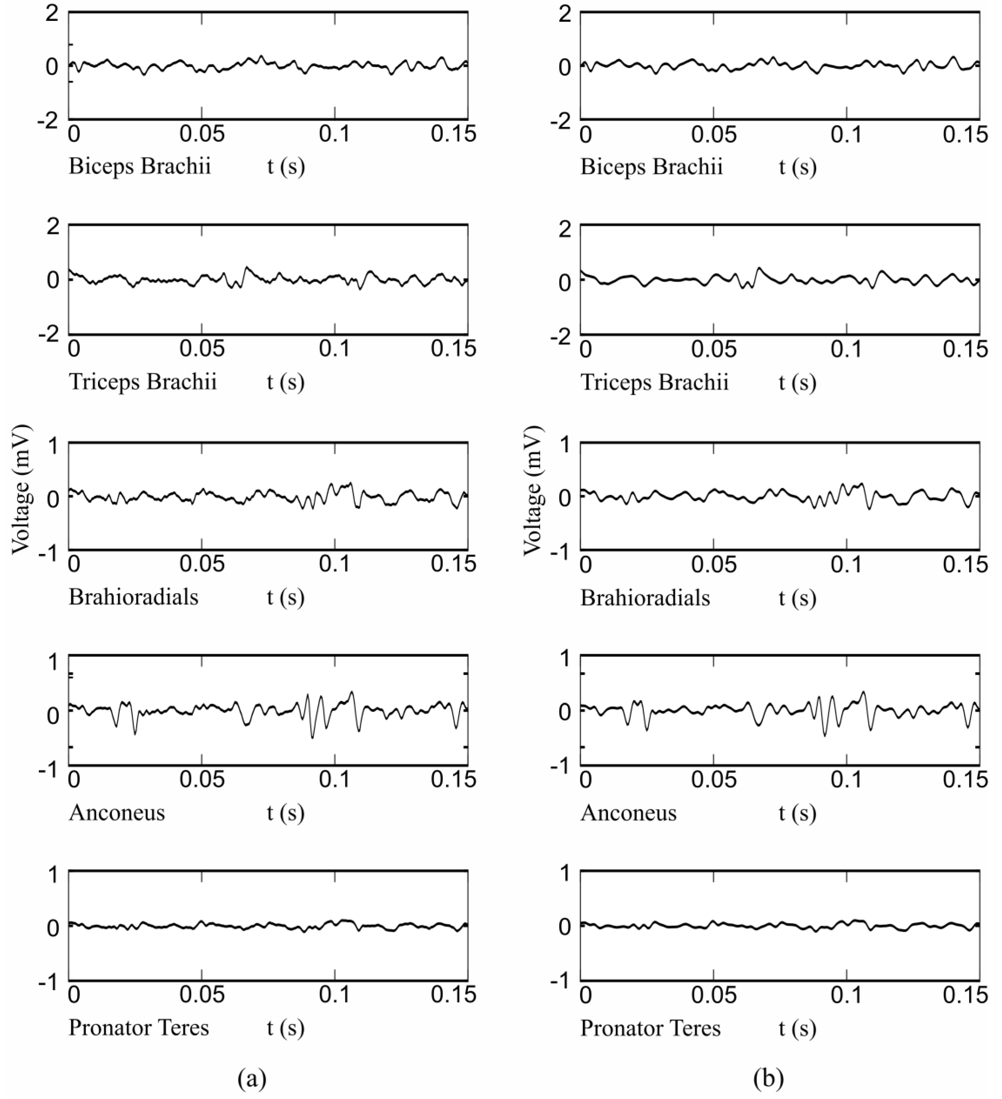 Sensors 17 01597 g015