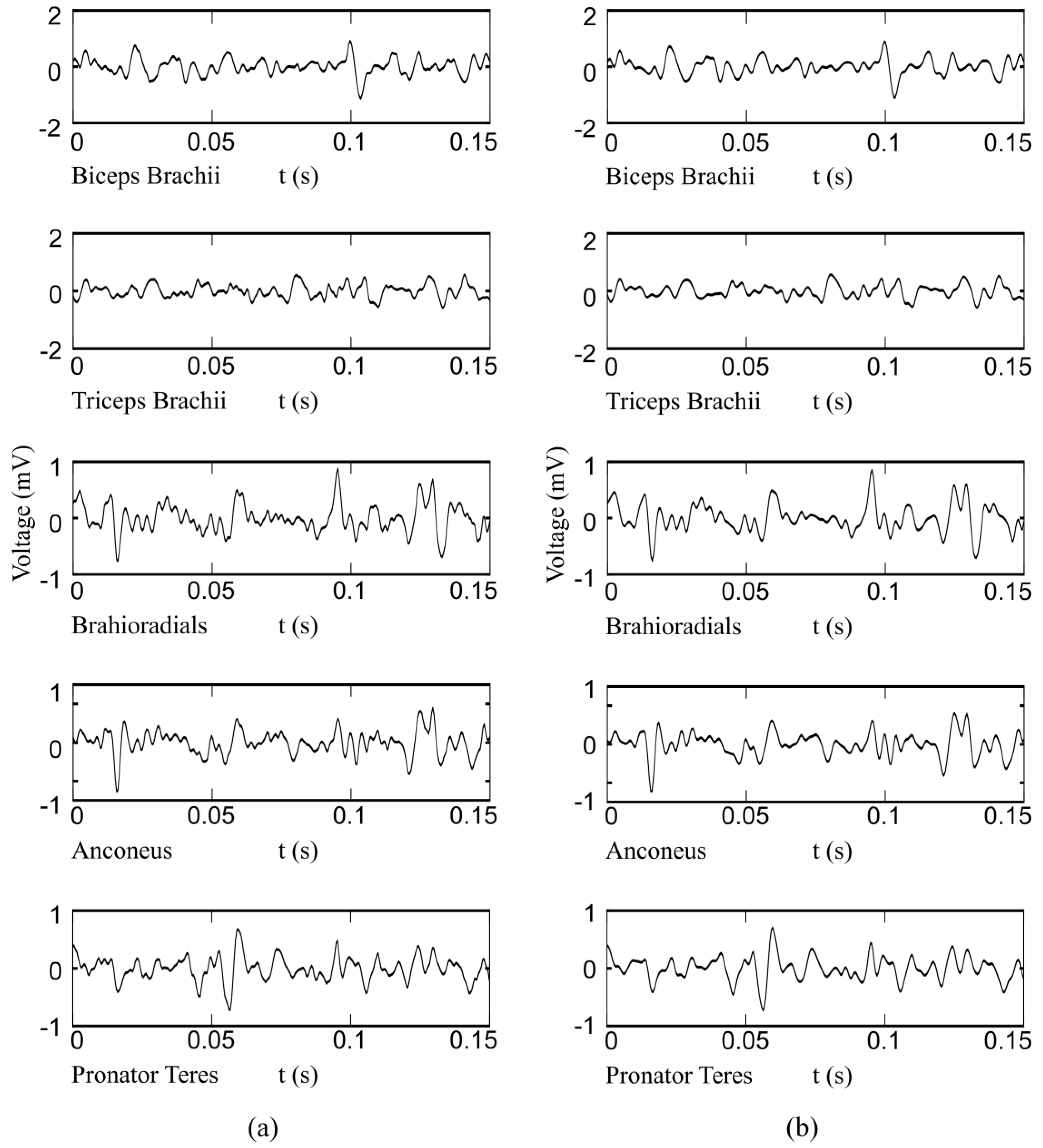 Sensors 17 01597 g016
