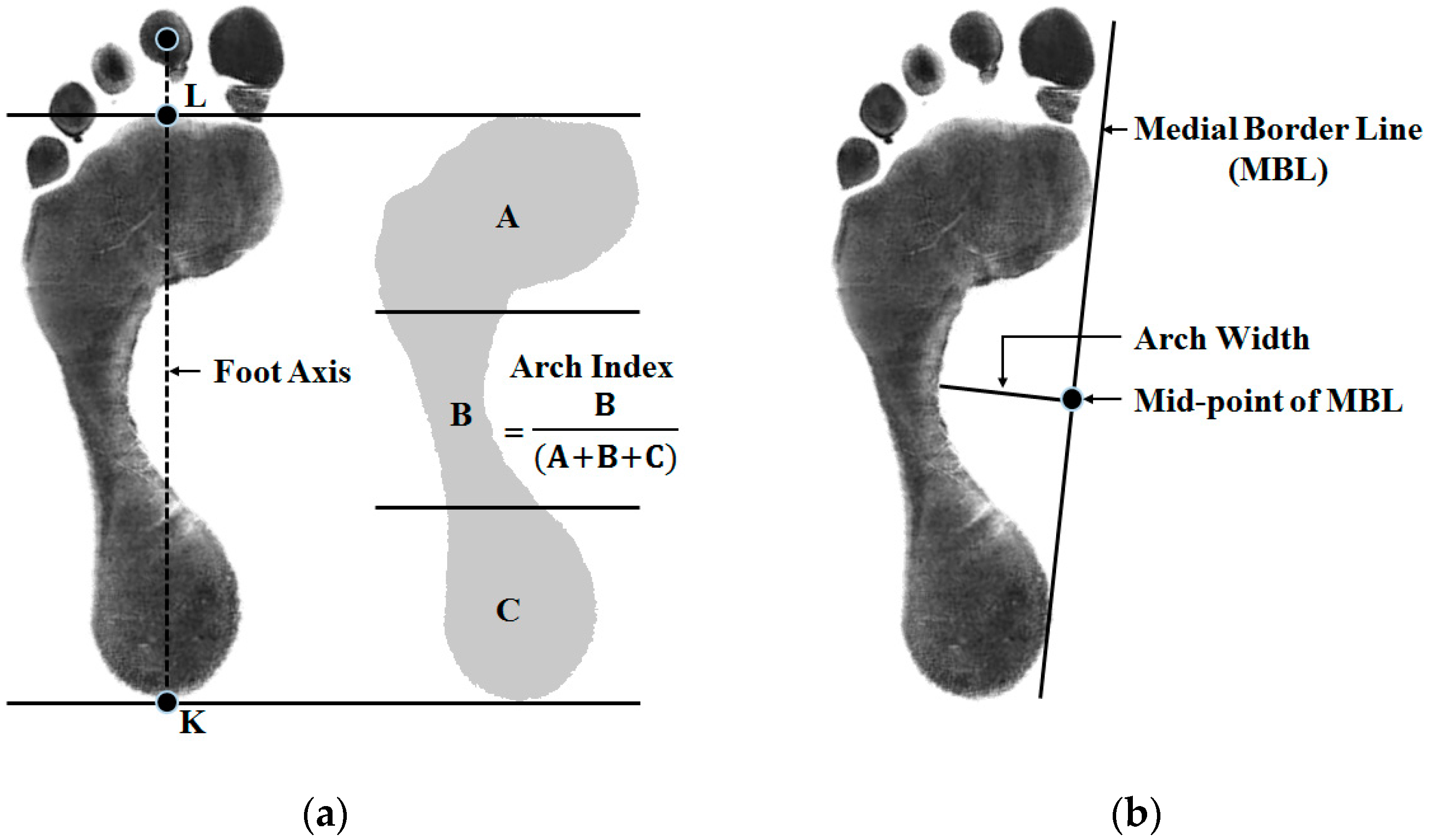 Box plots of foot dimensions. (A) Foot width box plot -male. (B) Instep