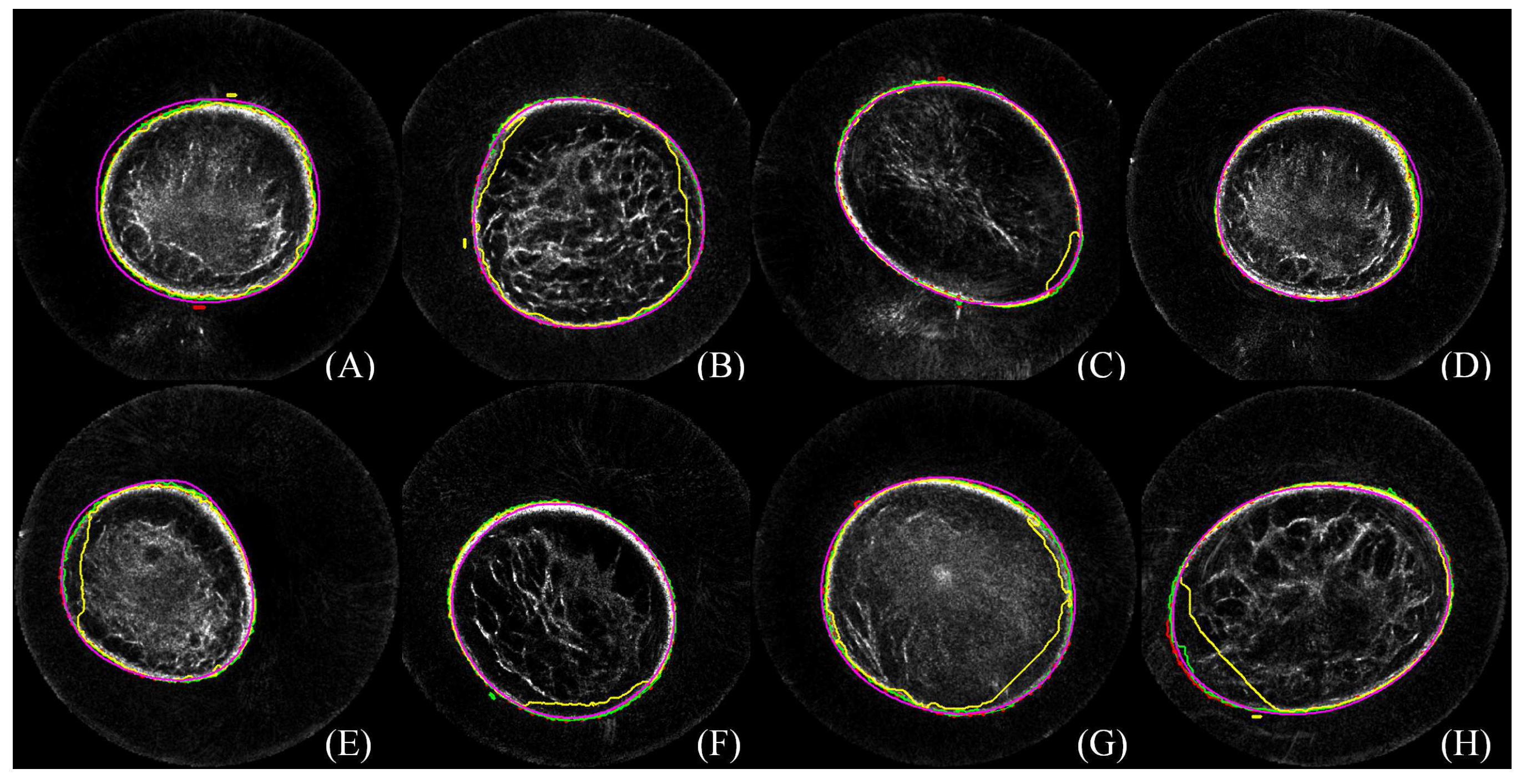 Sensors 17 01827 g005 Sensors 17 01827 g005