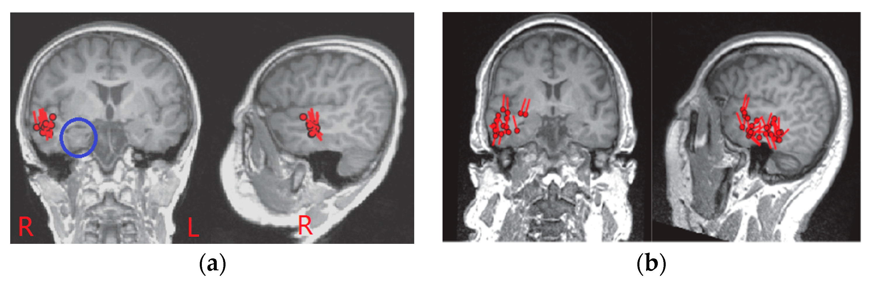 Sensors 17 01860 g006