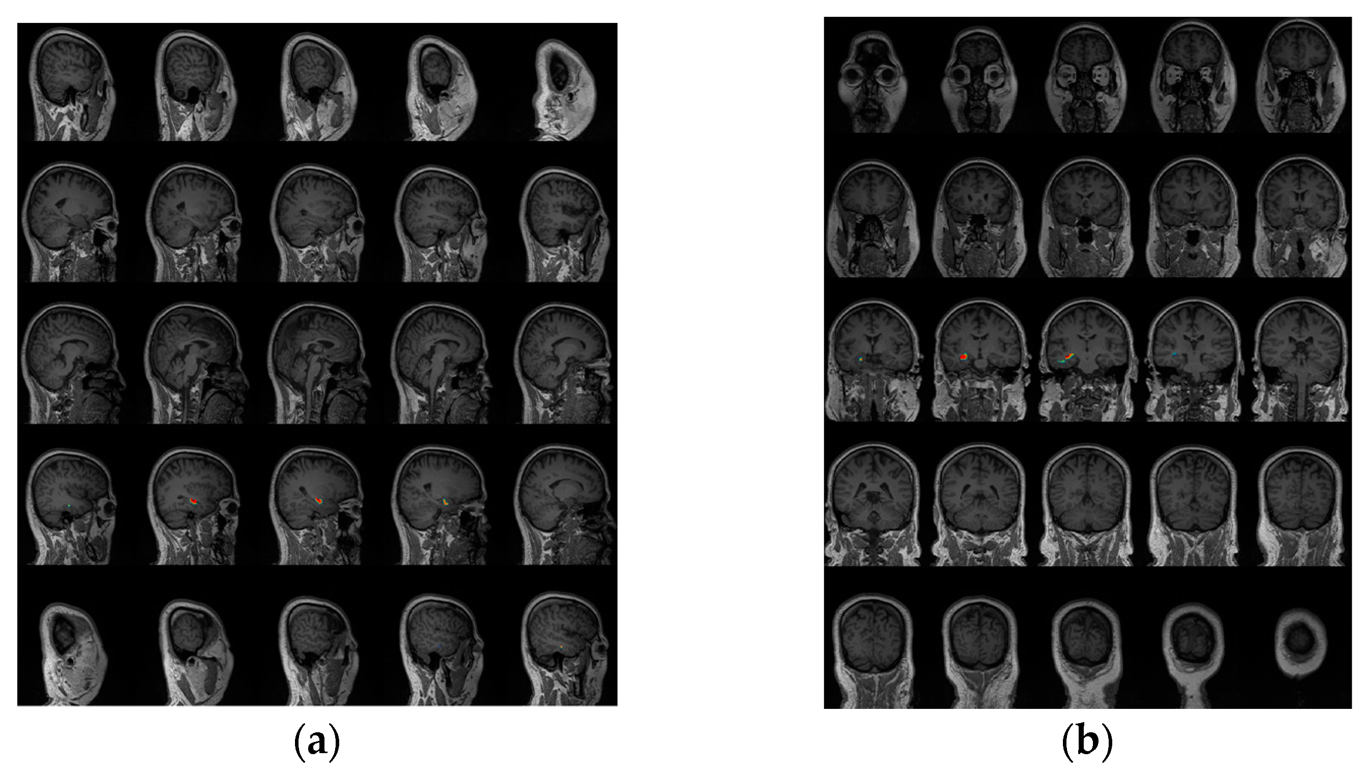 Sensors 17 01860 g008