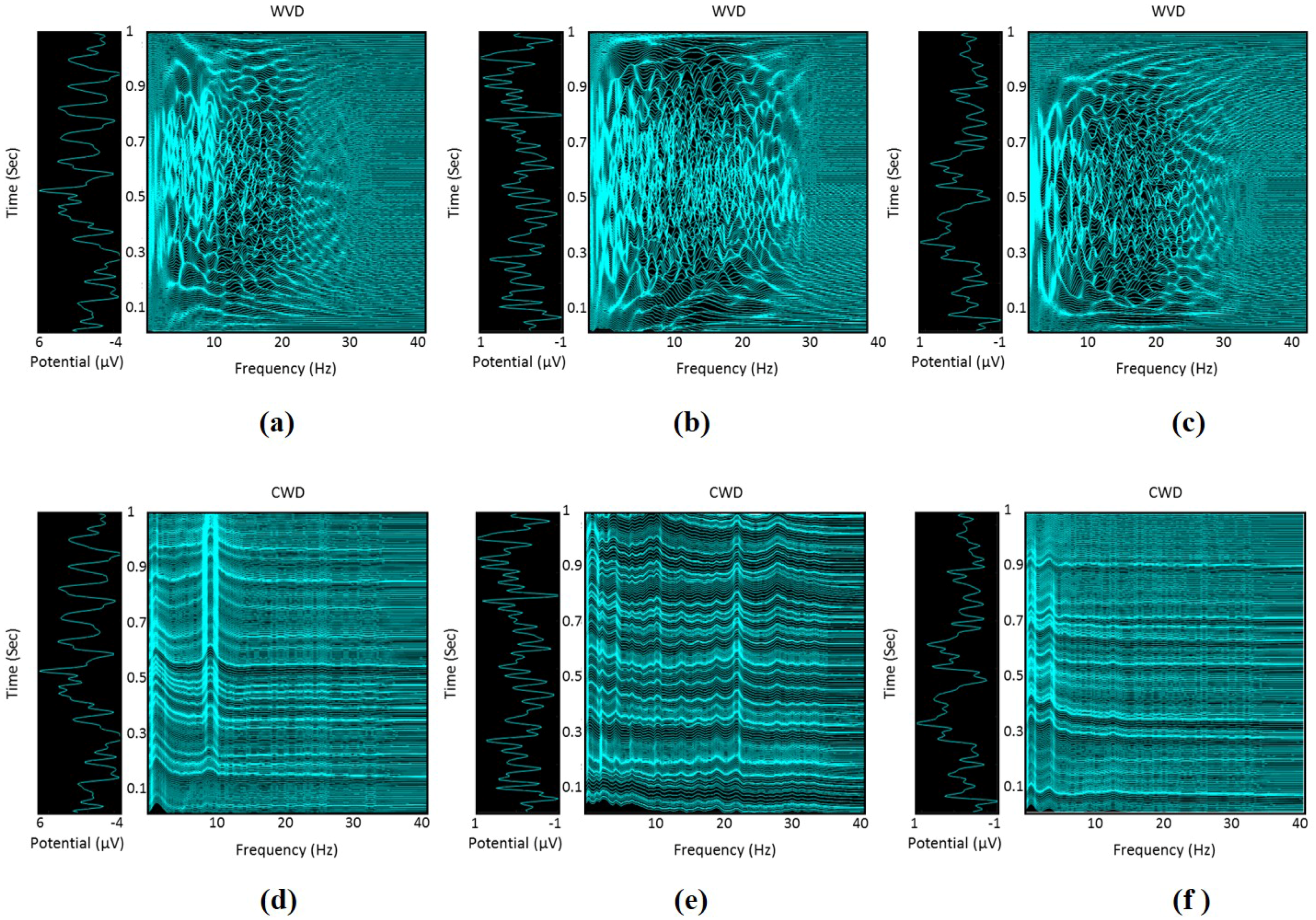 Sensors 17 01937 g004