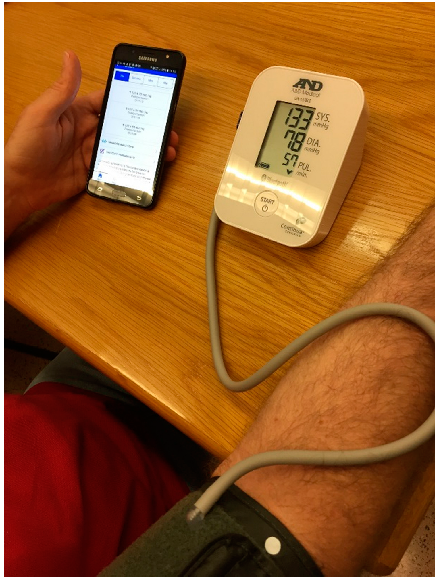 Sensors 17 02273 g008 550