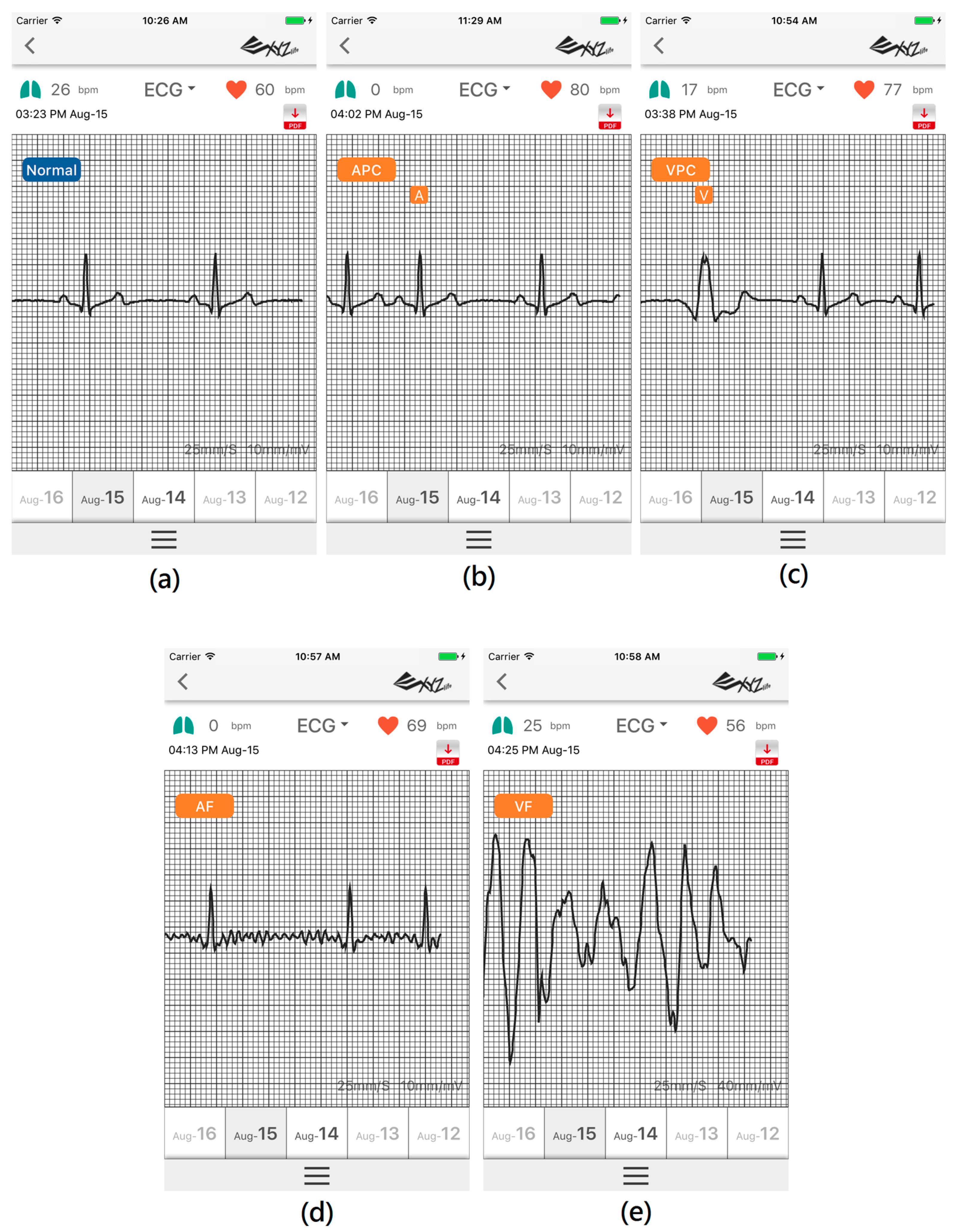 Sensors 17 02445 g004