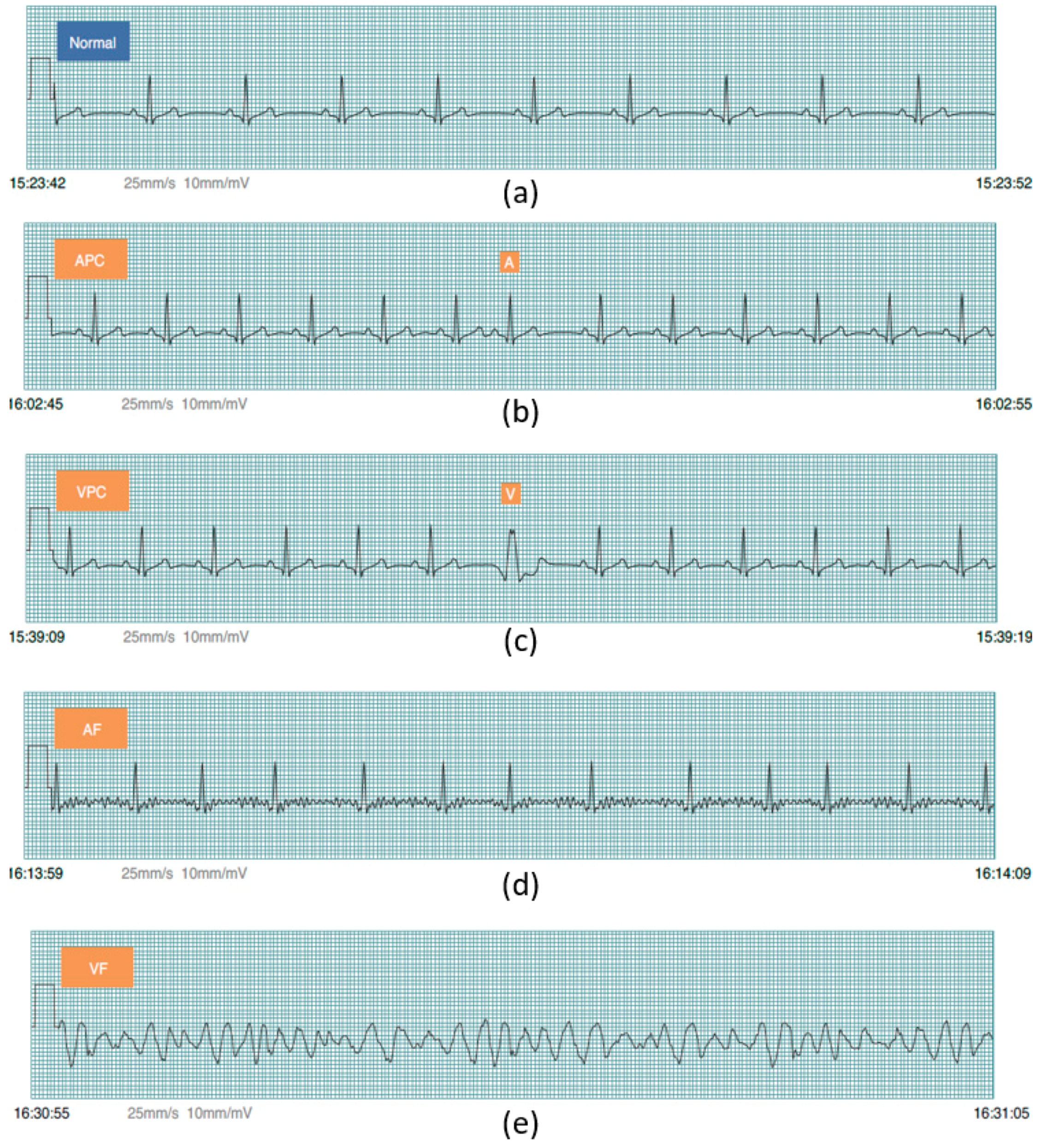 Sensors 17 02445 g005