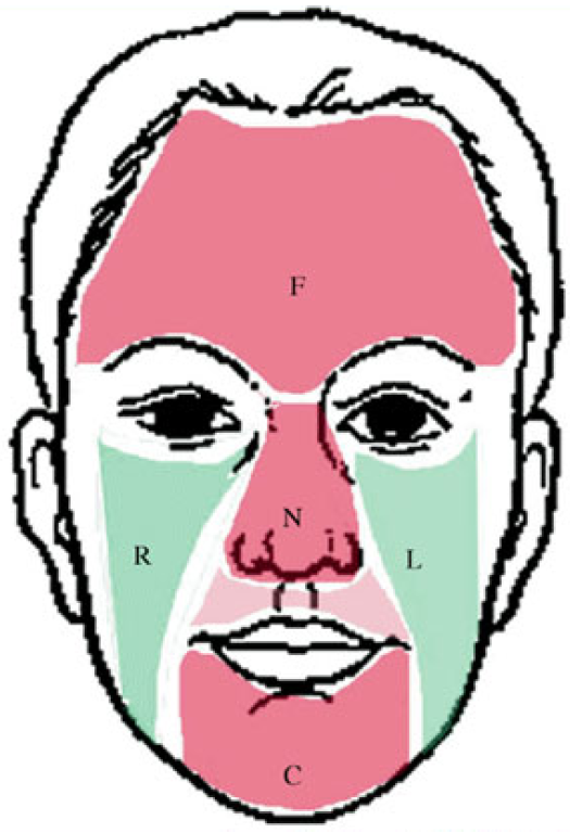 Sensors 17 02843 g006