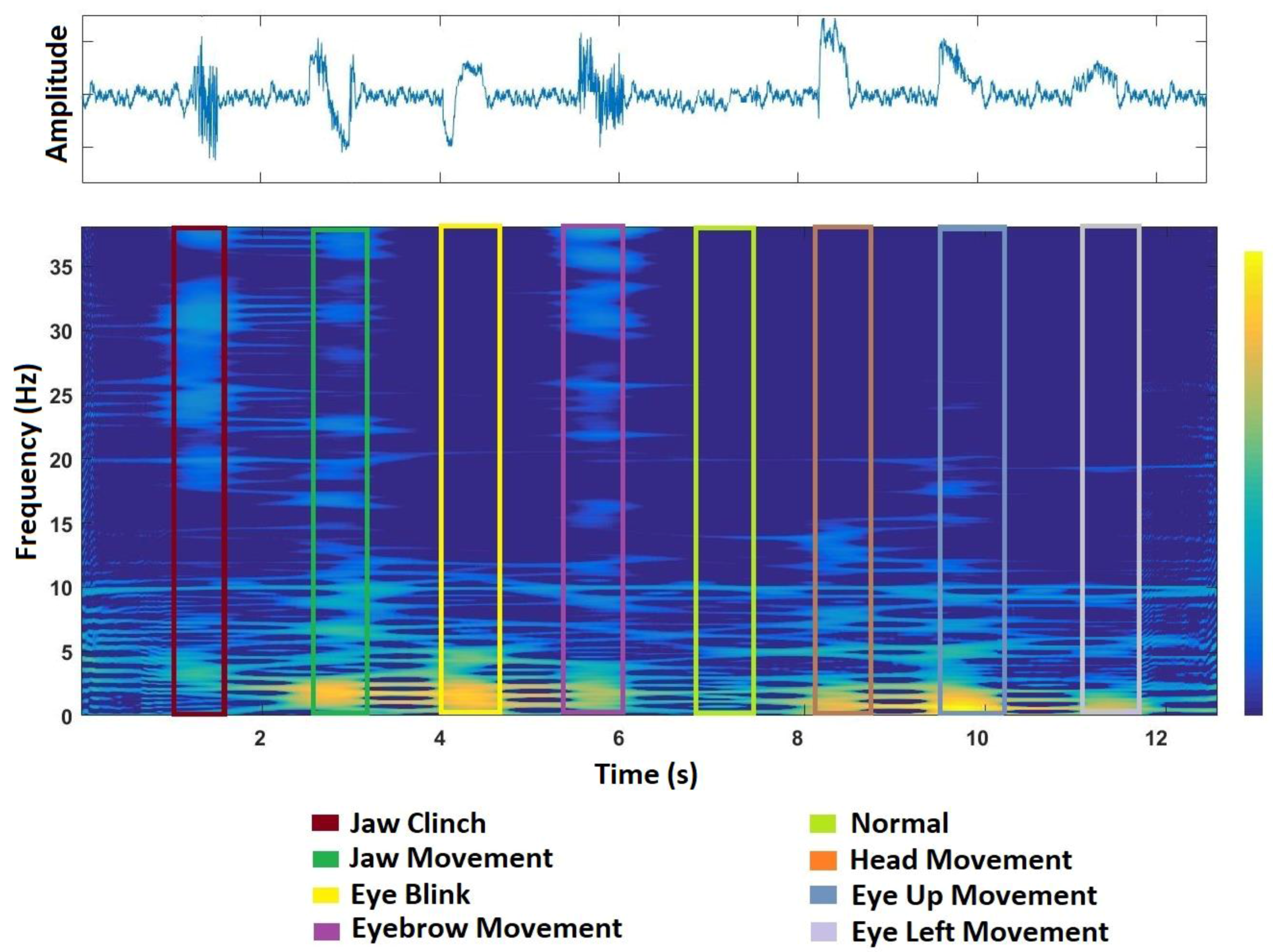 Sensors 17 02895 g003 550