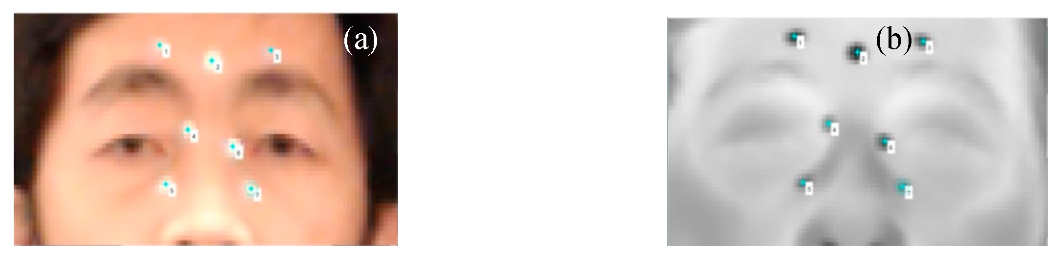 Sensors 18 00125 g007 550