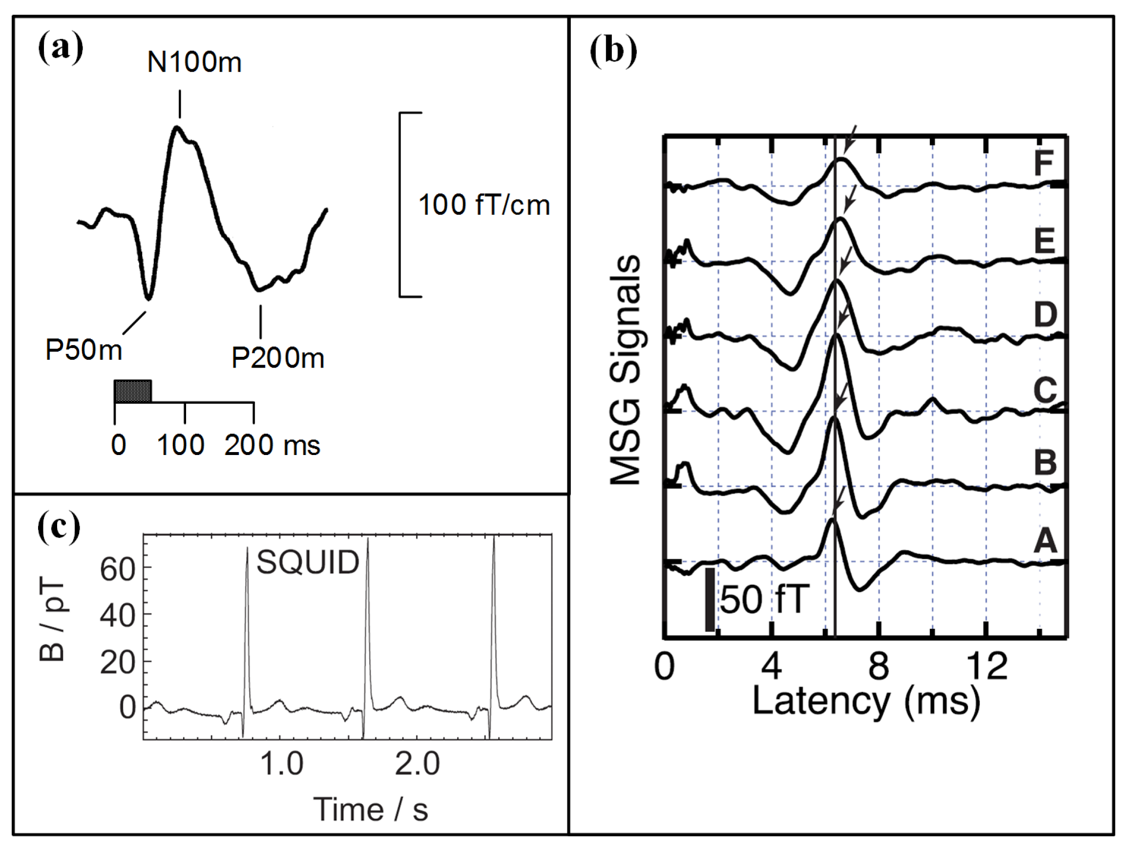 Sensors 18 00148 g004