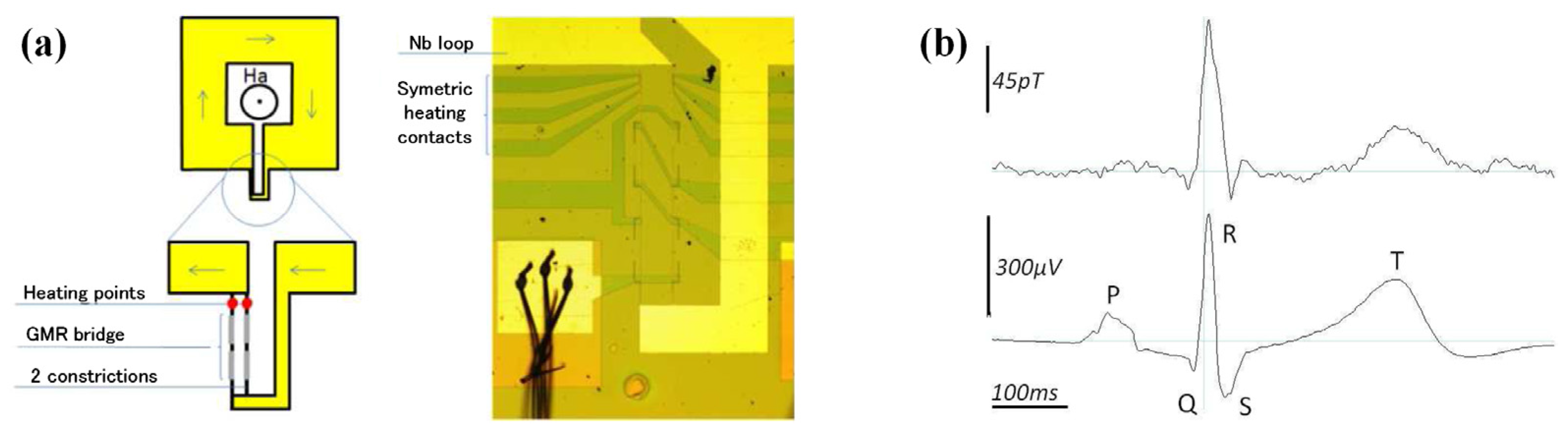 Sensors 18 00148 g014