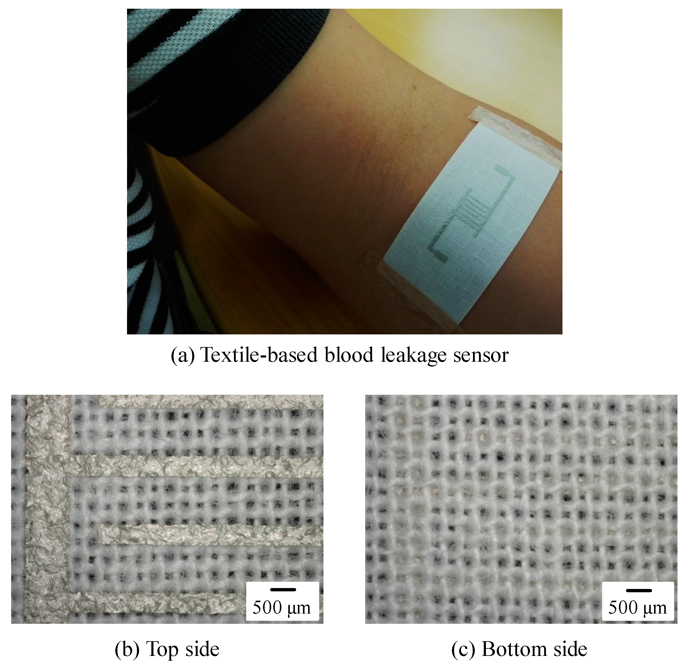 Sensors 18 00240 g002 Sensors 18 00240 g002